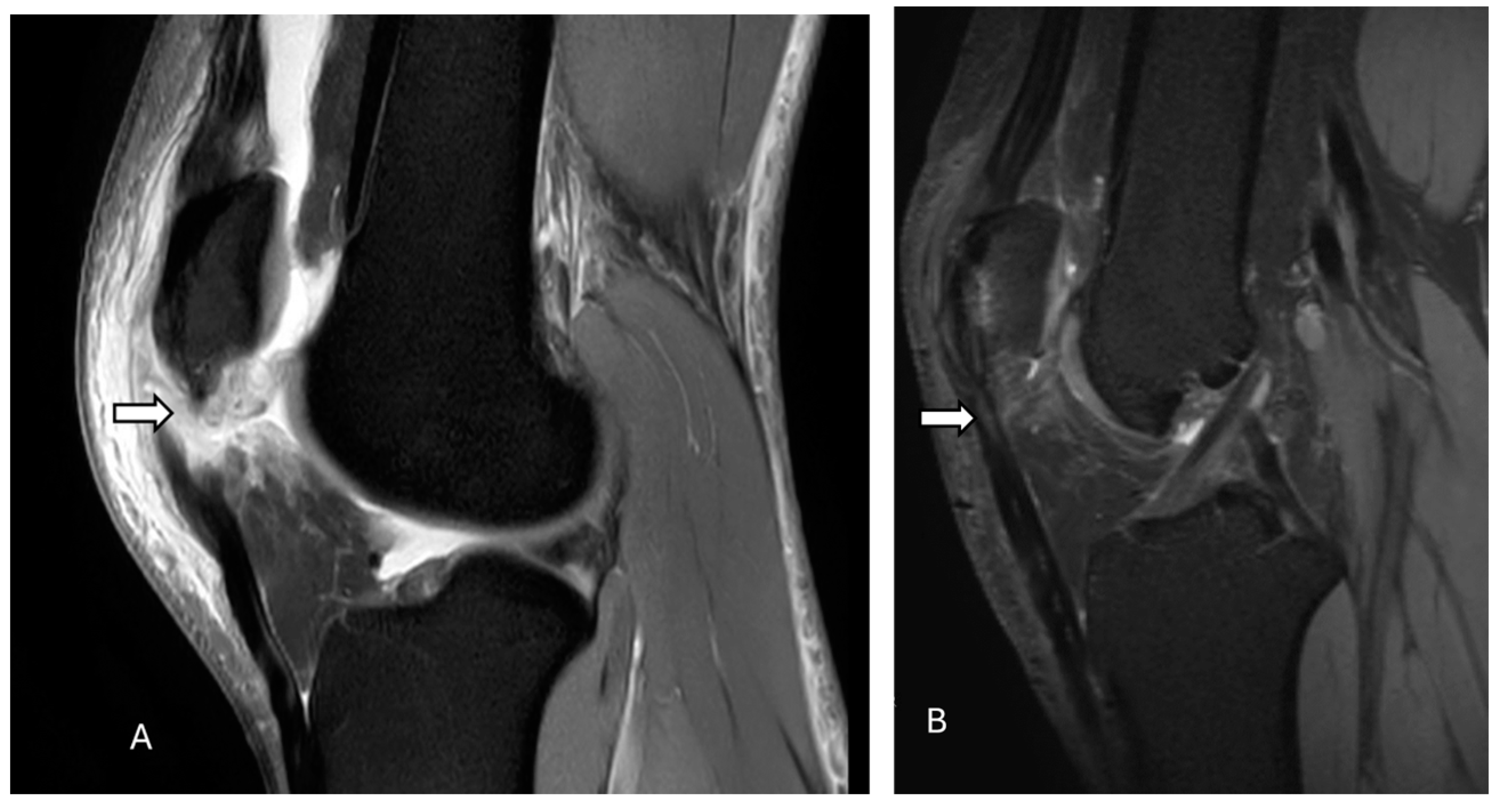 Diagnostics 14 02828 g007 Diagnostics 14 02828 g007