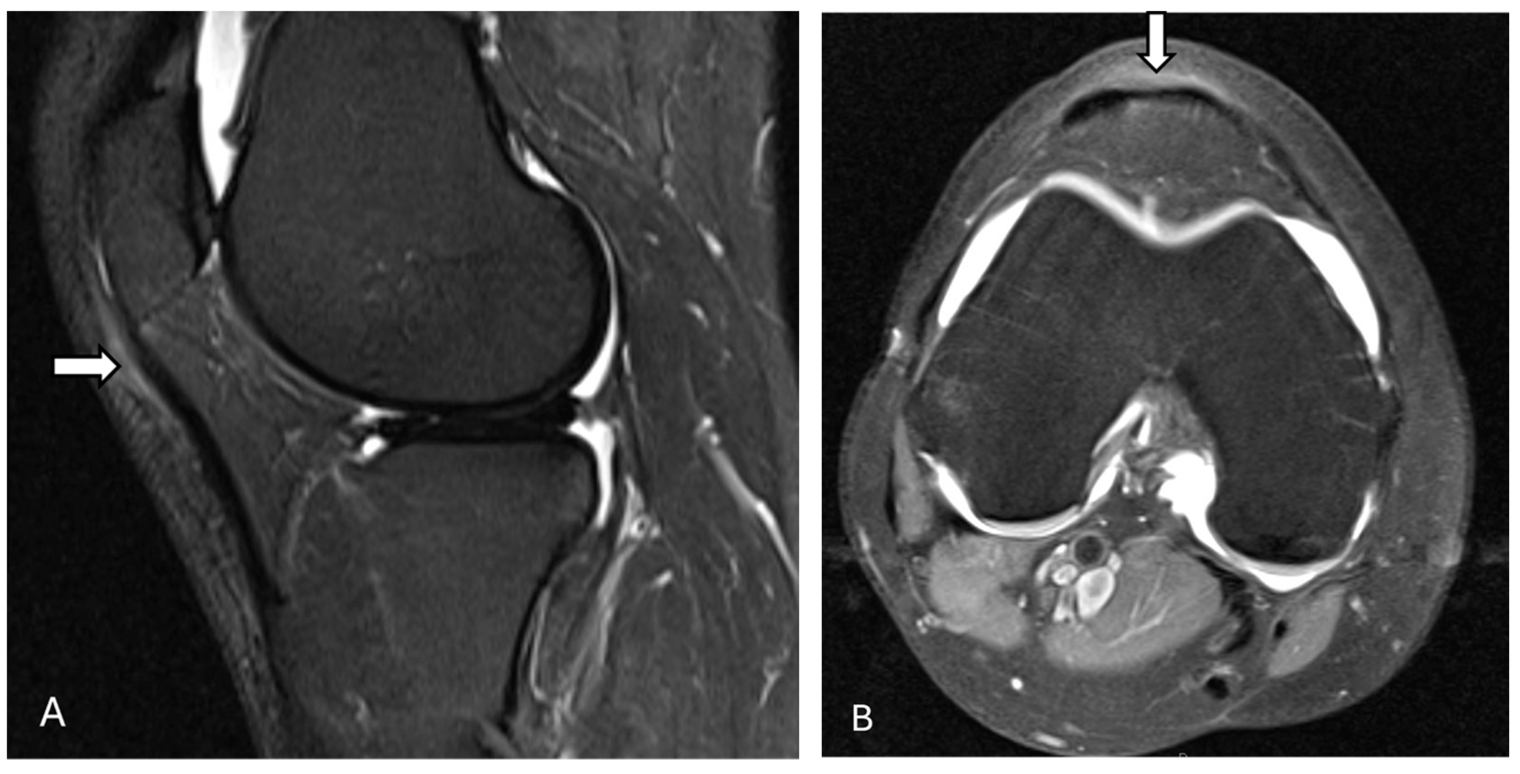 Diagnostics 14 02828 g009 Diagnostics 14 02828 g009