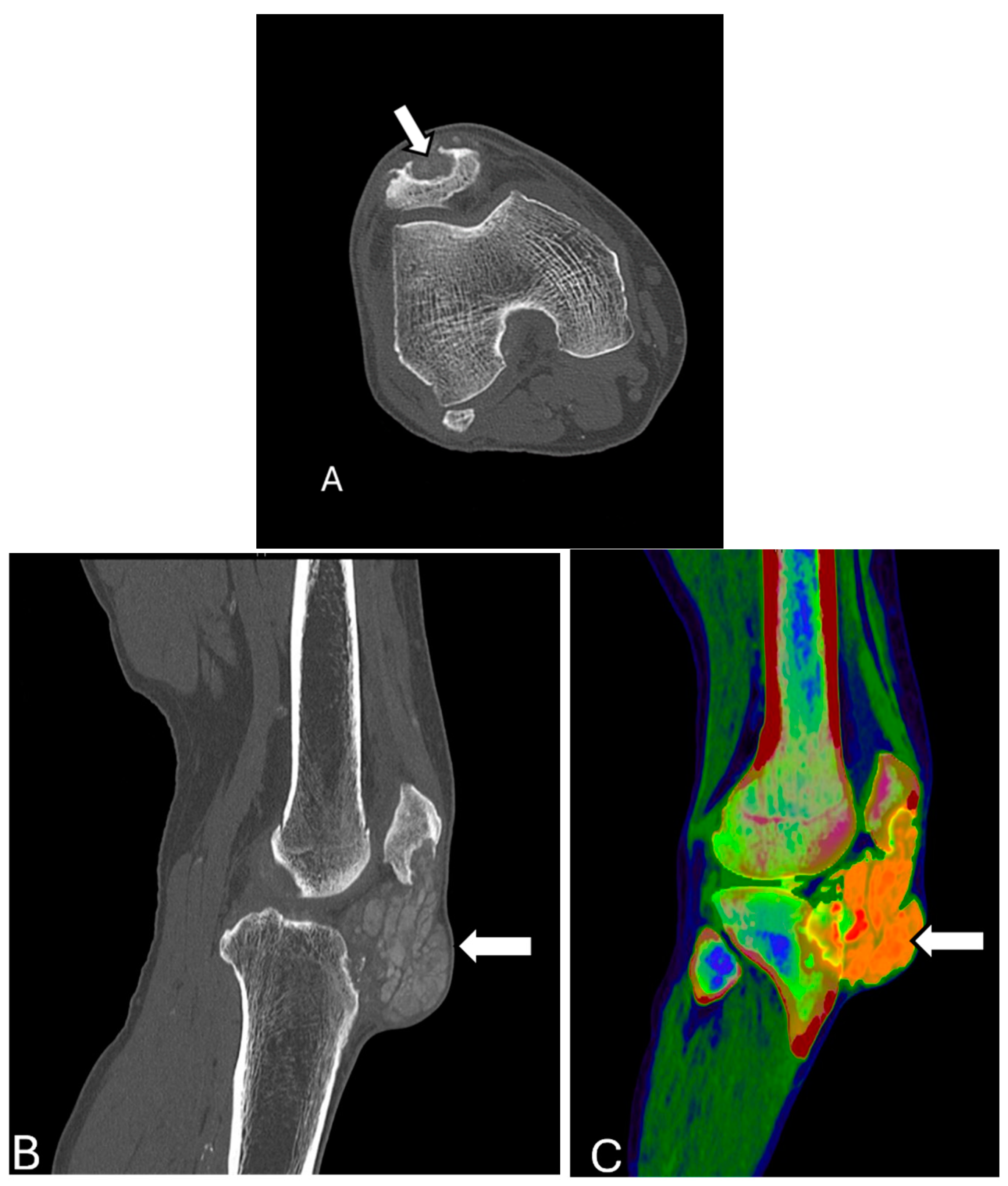 Diagnostics 14 02828 g014 Diagnostics 14 02828 g014