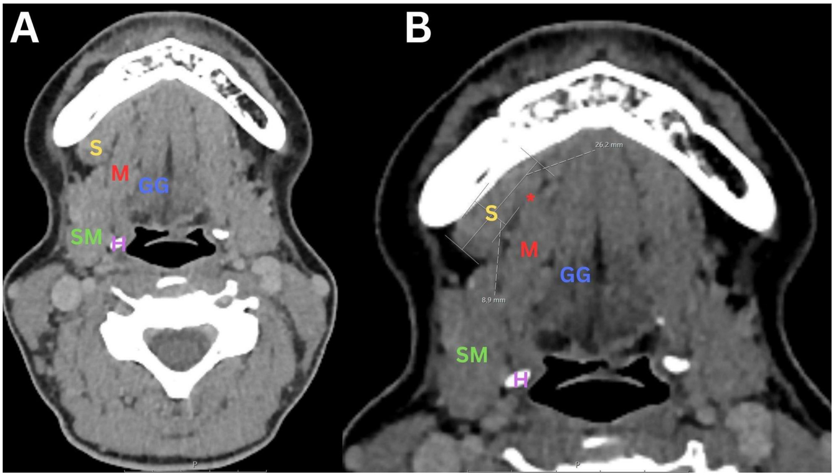 Diagnostics 14 02833 g001