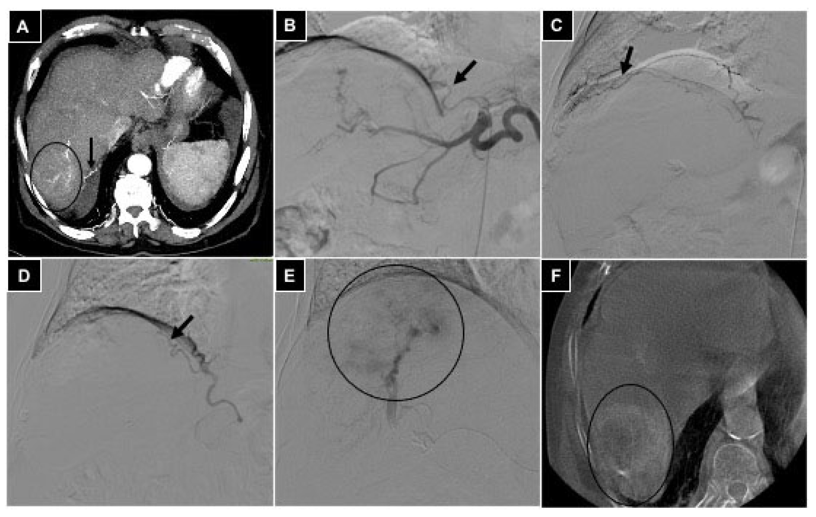 Diagnostics 14 02844 g004