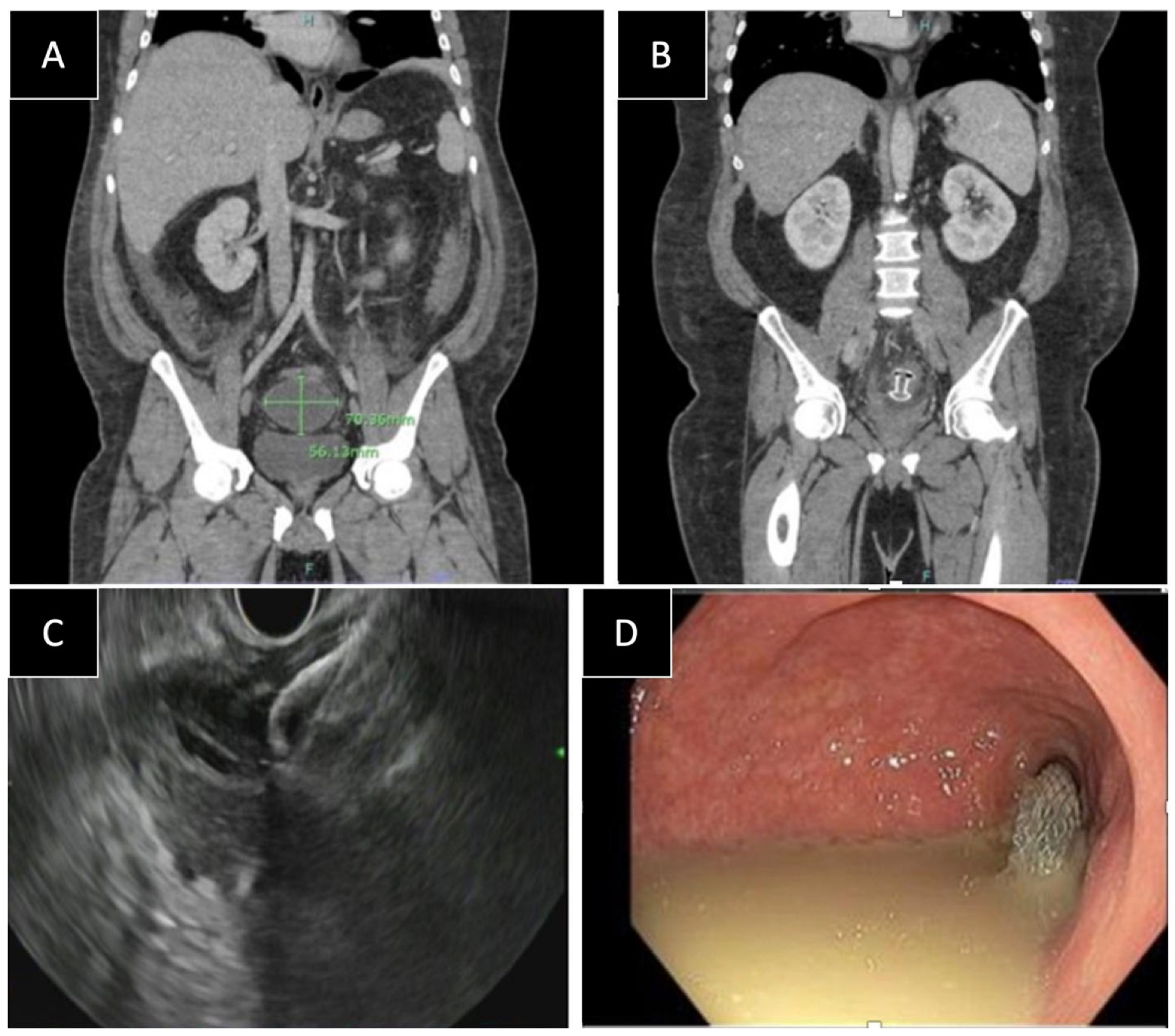 Diagnostics 14 02854 g001 Diagnostics 14 02854 g001