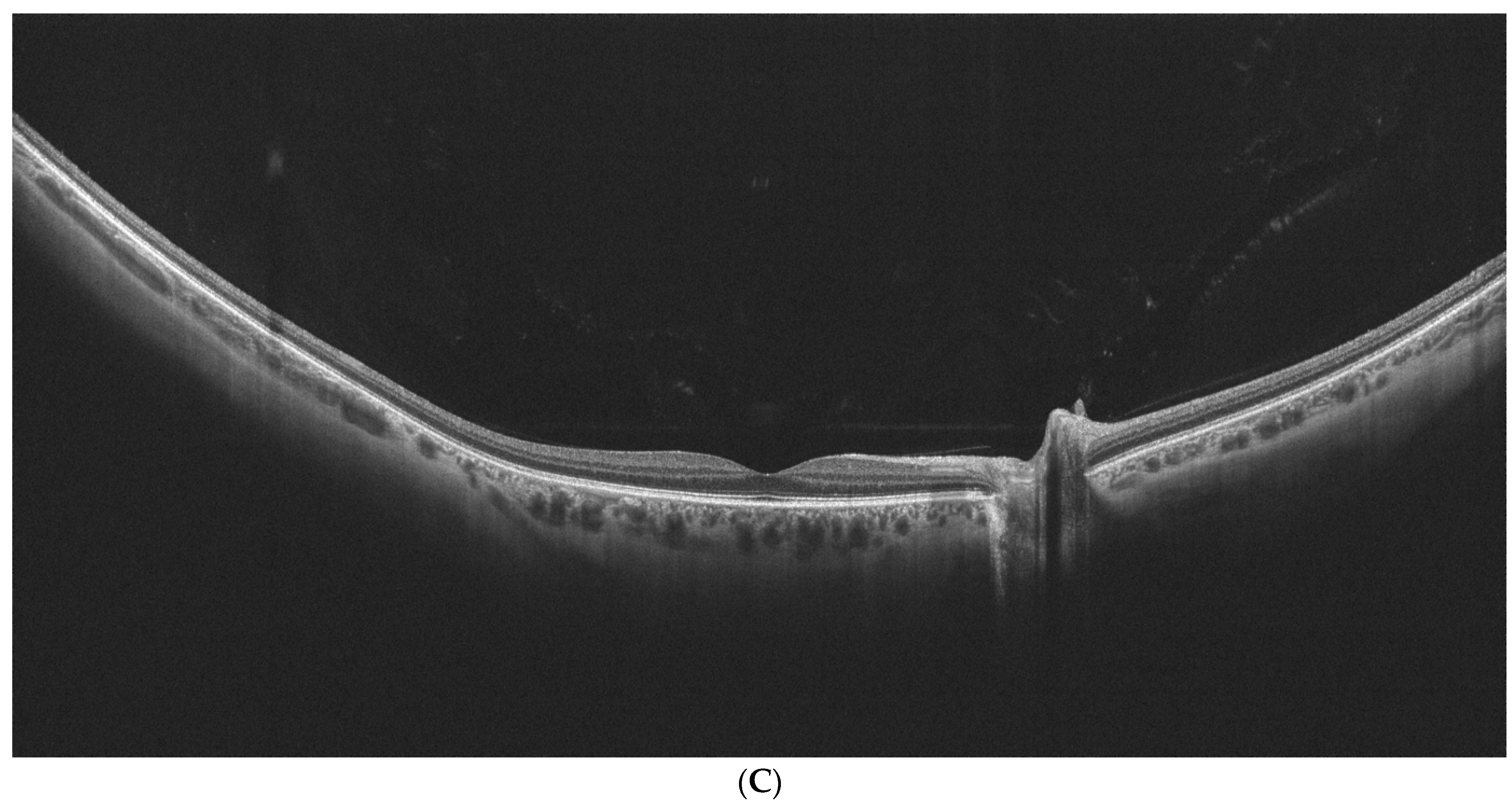 Diagnostics 14 02868 g002b