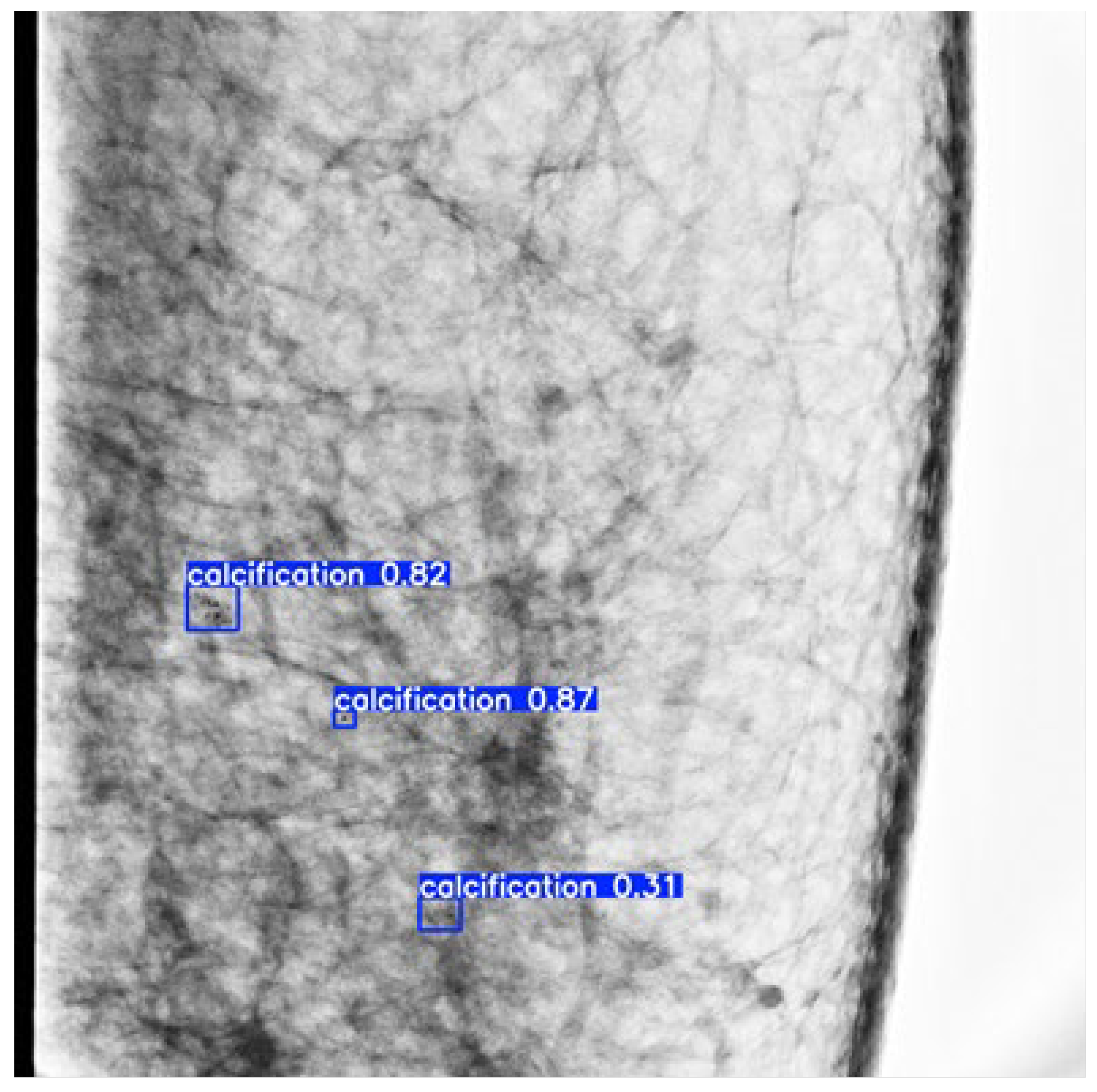 Diagnostics 14 02875 g004