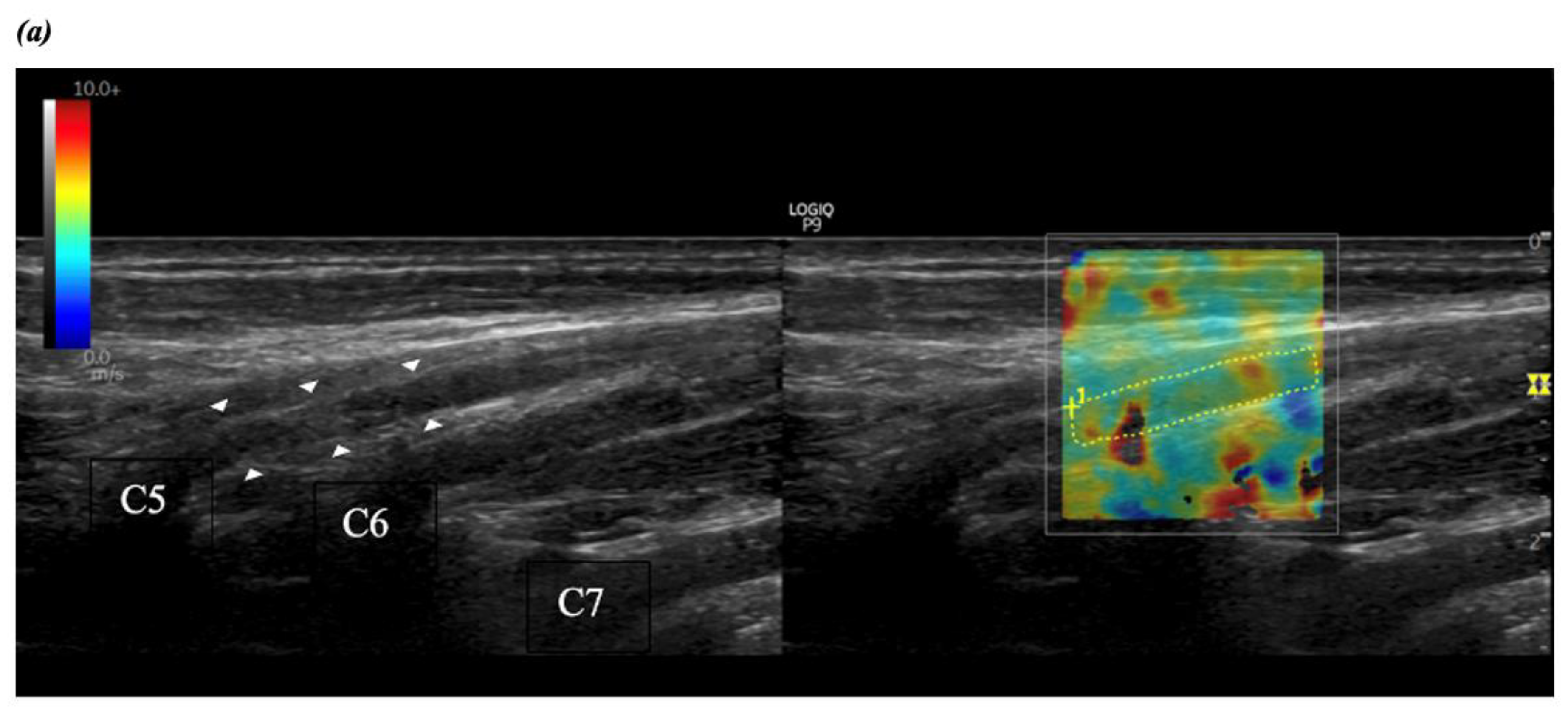 Diagnostics 14 02881 g001a