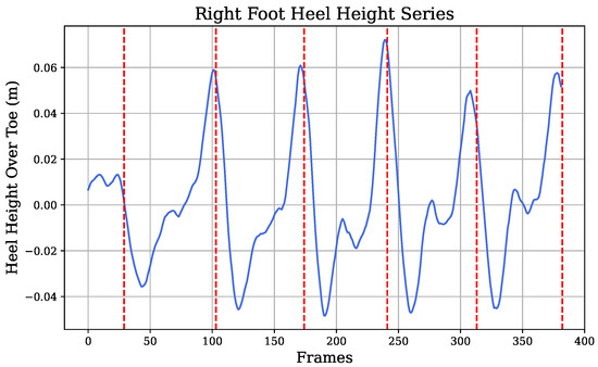 Gait-Based AI Models for Detecting Sarcopenia and Cognitive Decline ...