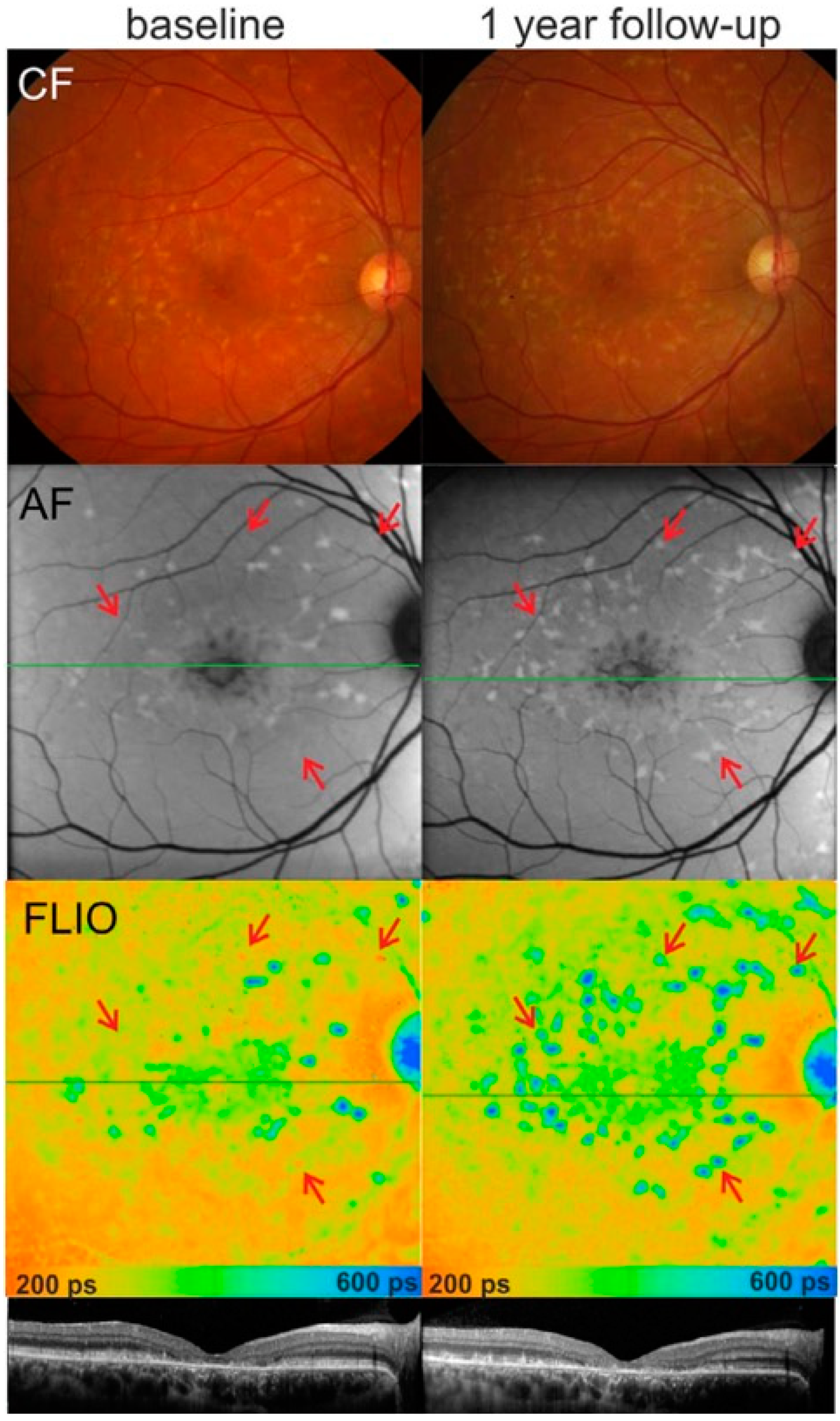 Diagnostics 15 00028 g001