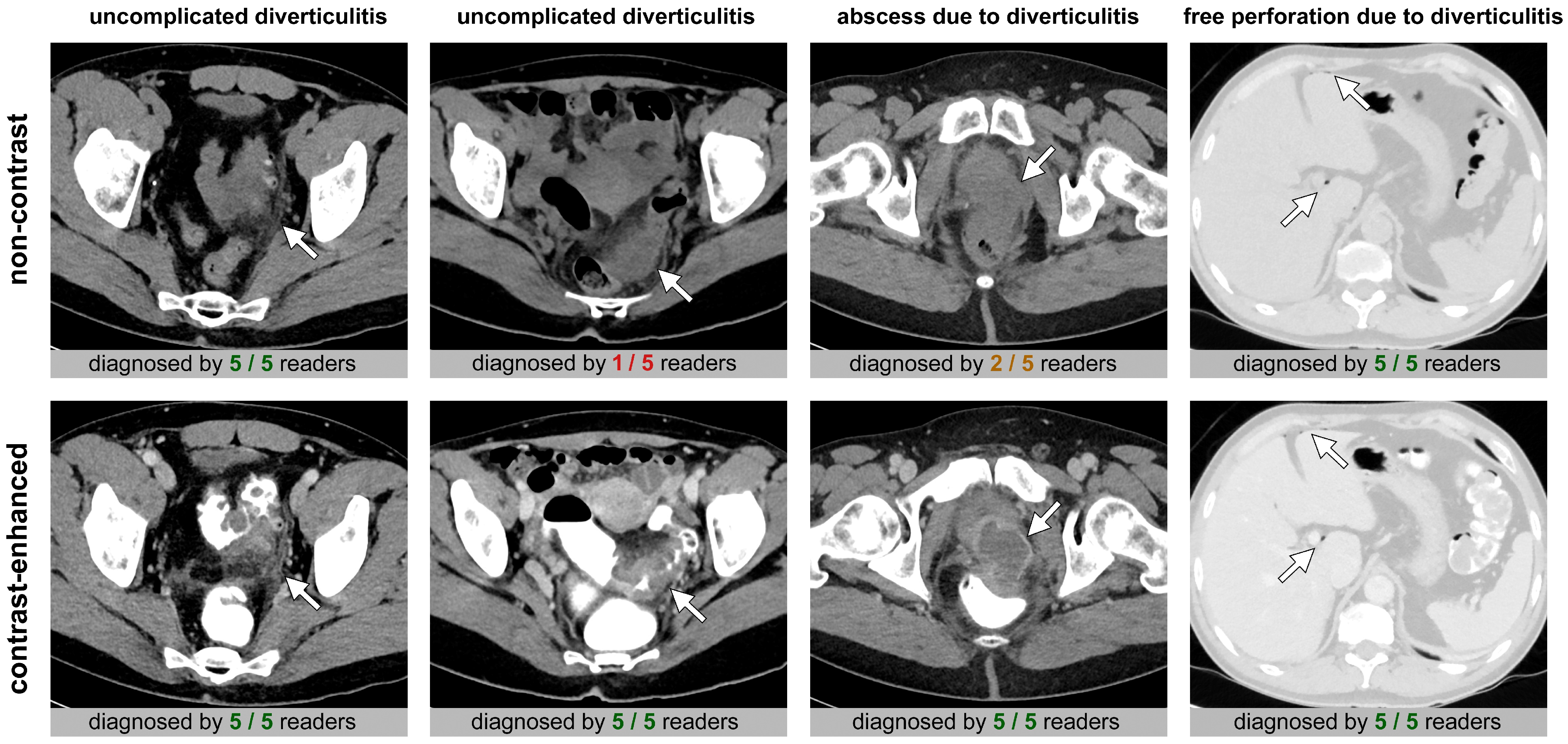 Diagnostics 15 00029 g004 Diagnostics 15 00029 g004
