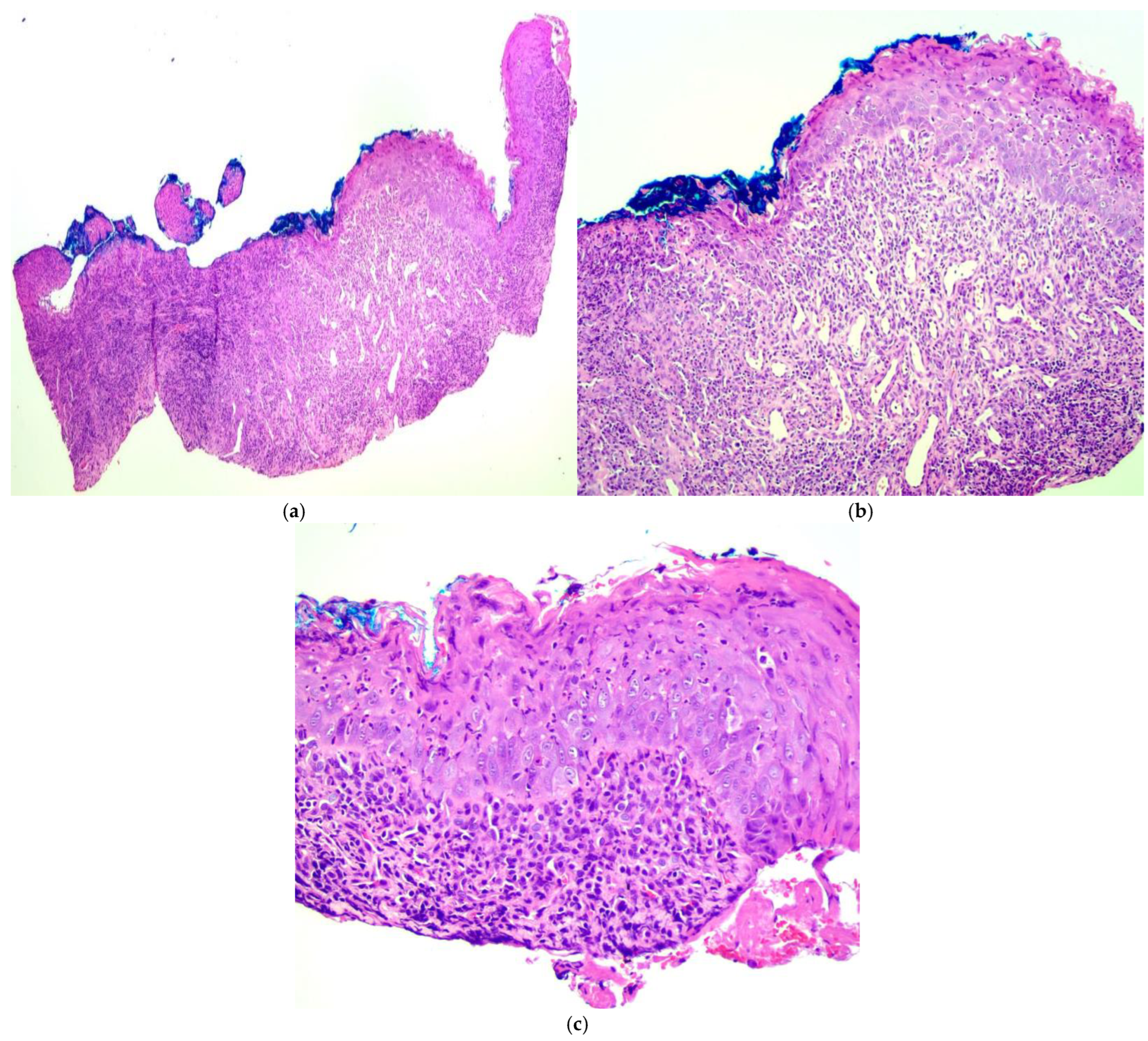 Diagnostics 15 00035 g003 Diagnostics 15 00035 g003