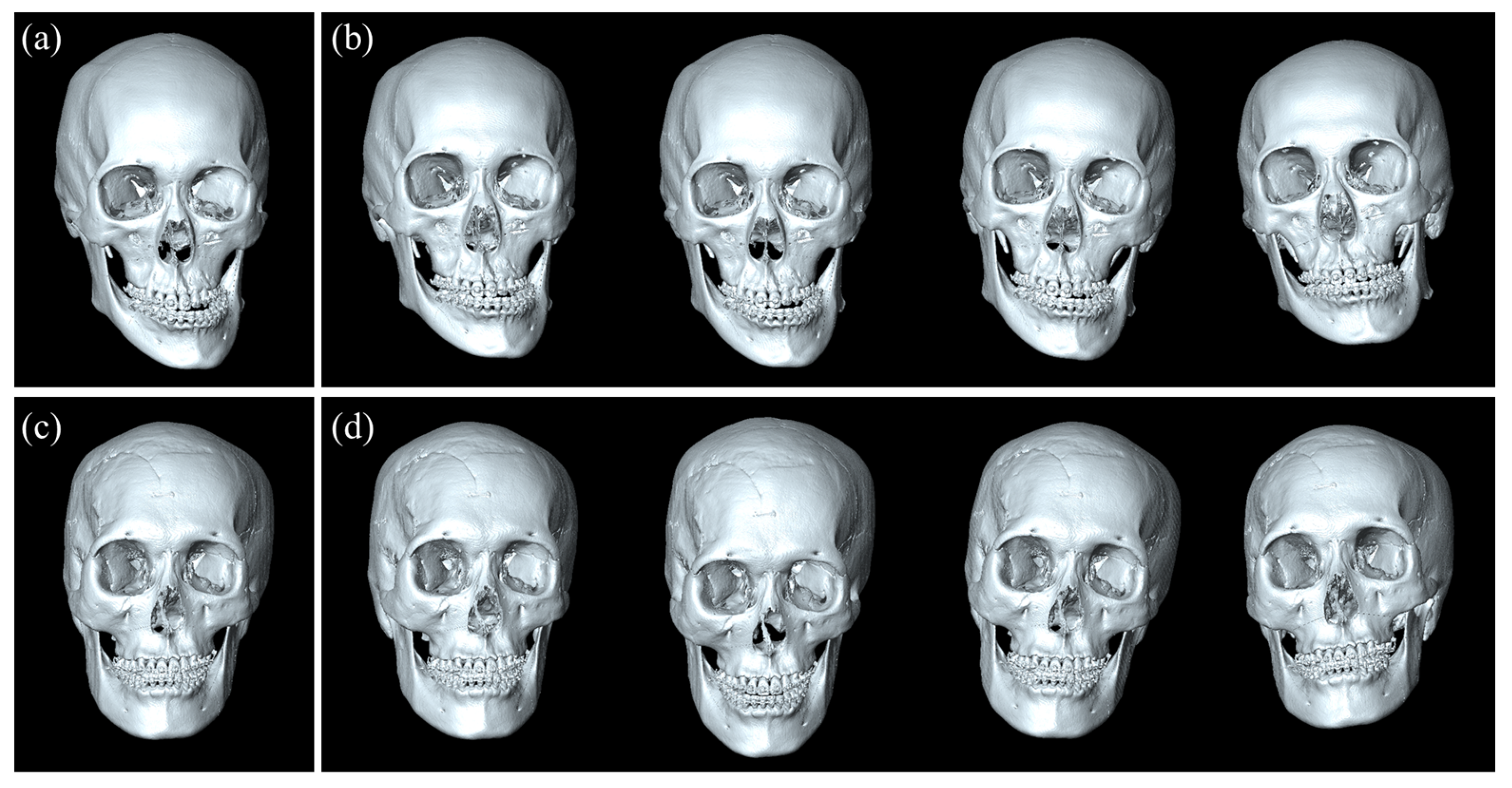 Diagnostics 15 00042 g004
