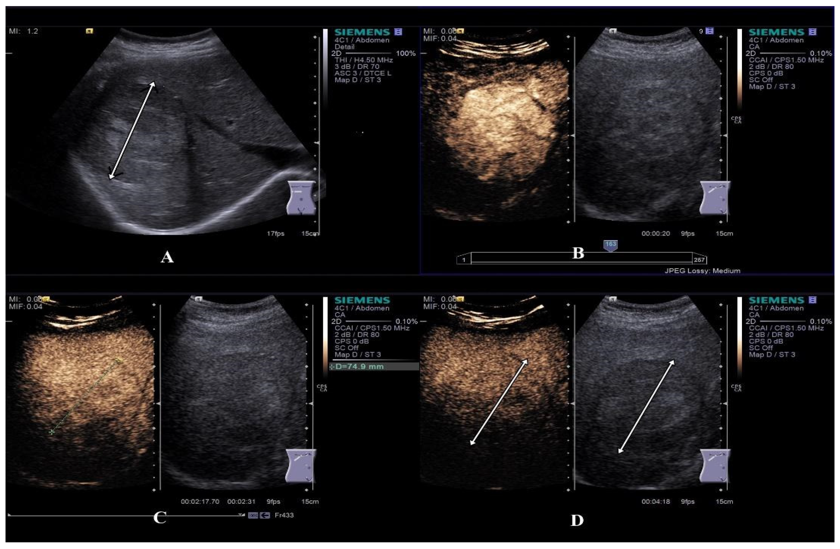 Diagnostics 15 00046 g002