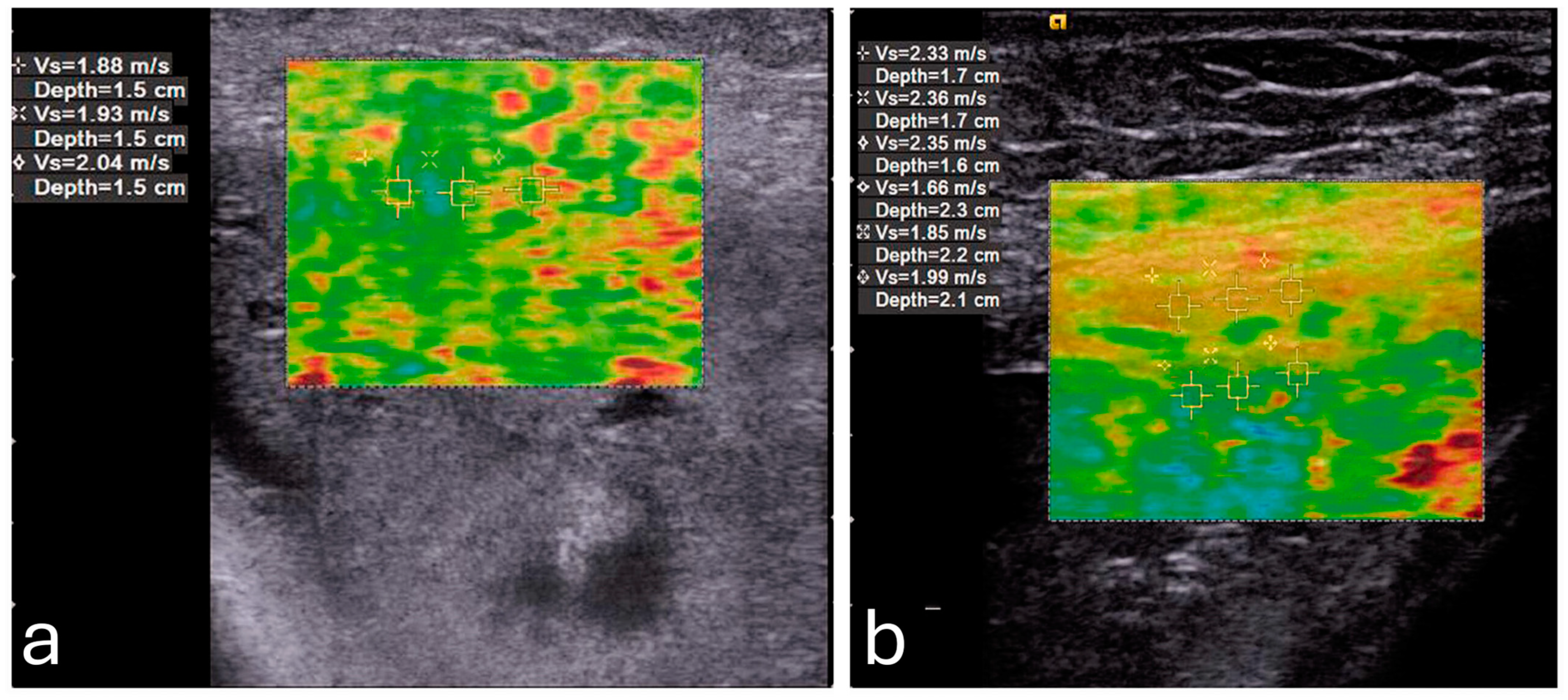 Diagnostics 15 00047 g002