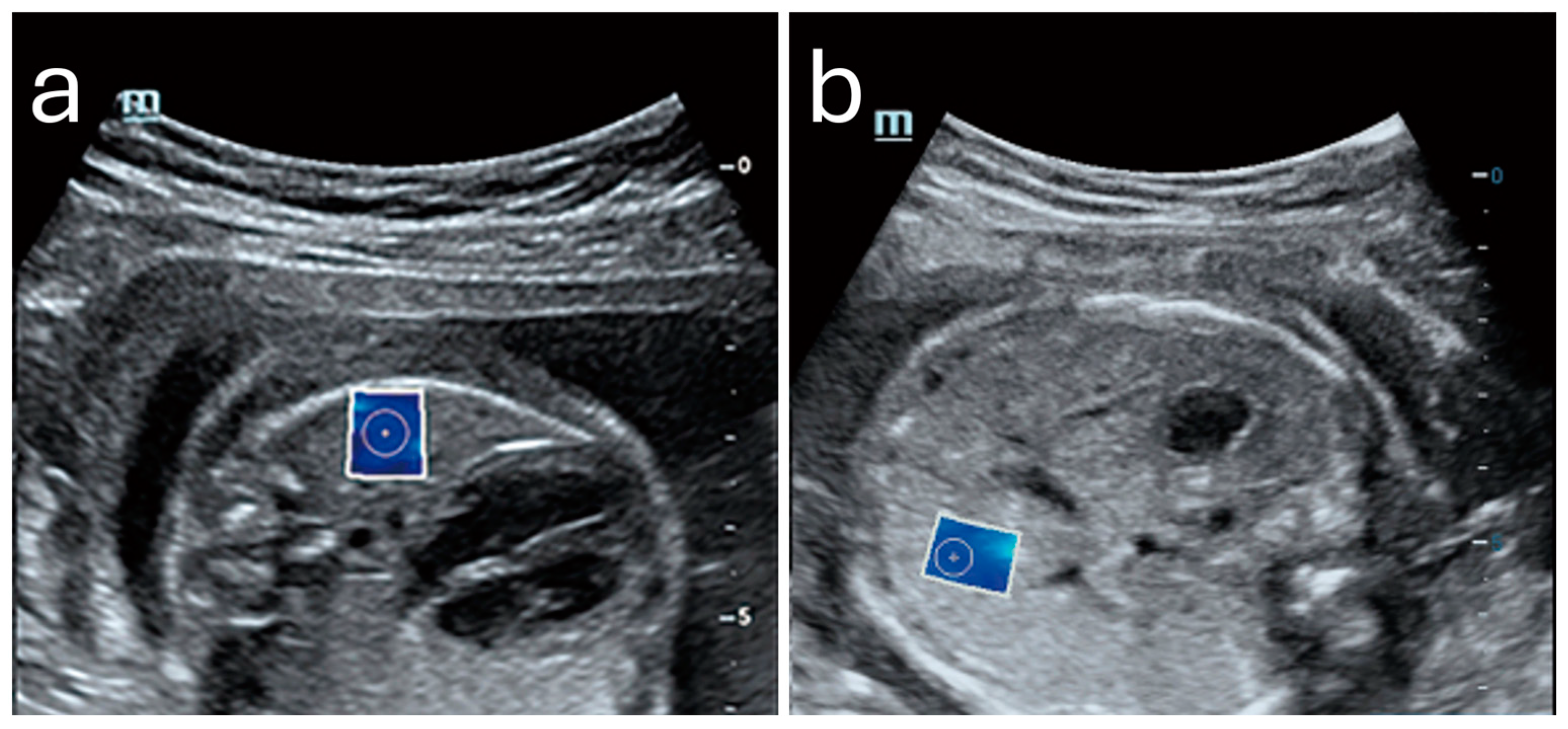 Diagnostics 15 00047 g004