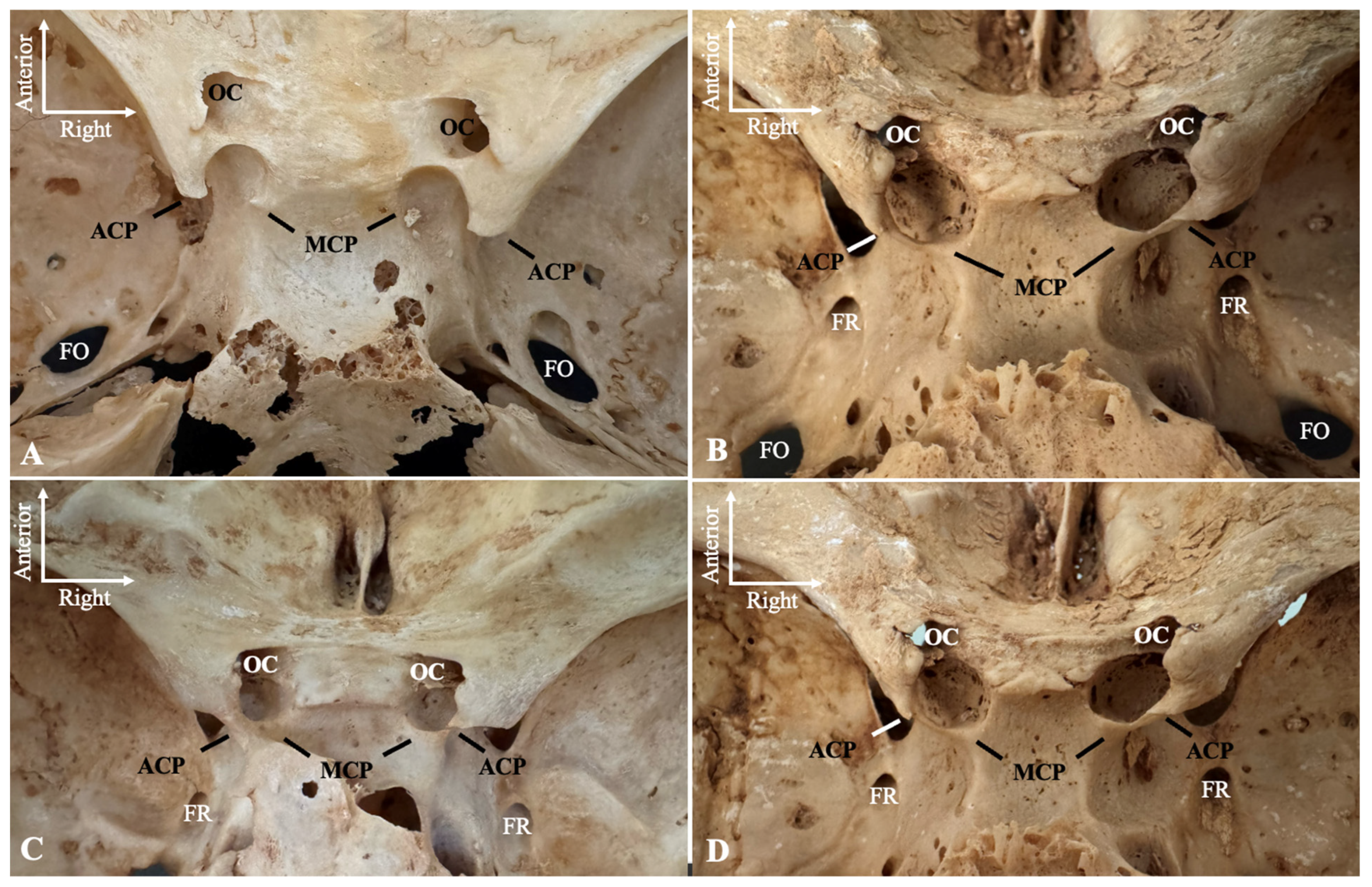 Diagnostics 15 00076 g002