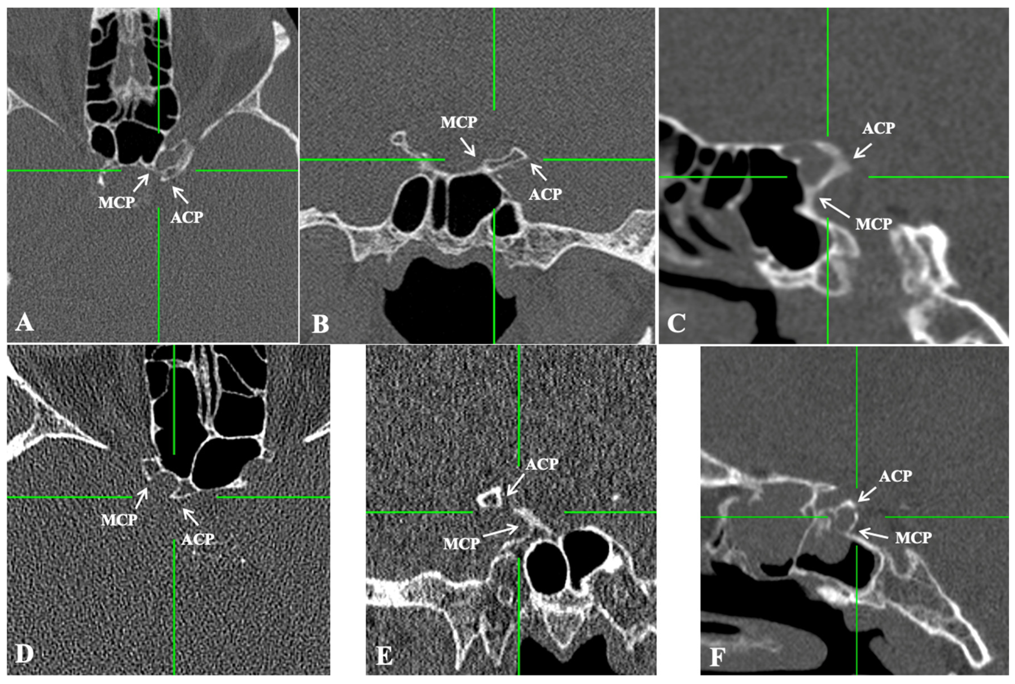 Diagnostics 15 00076 g003