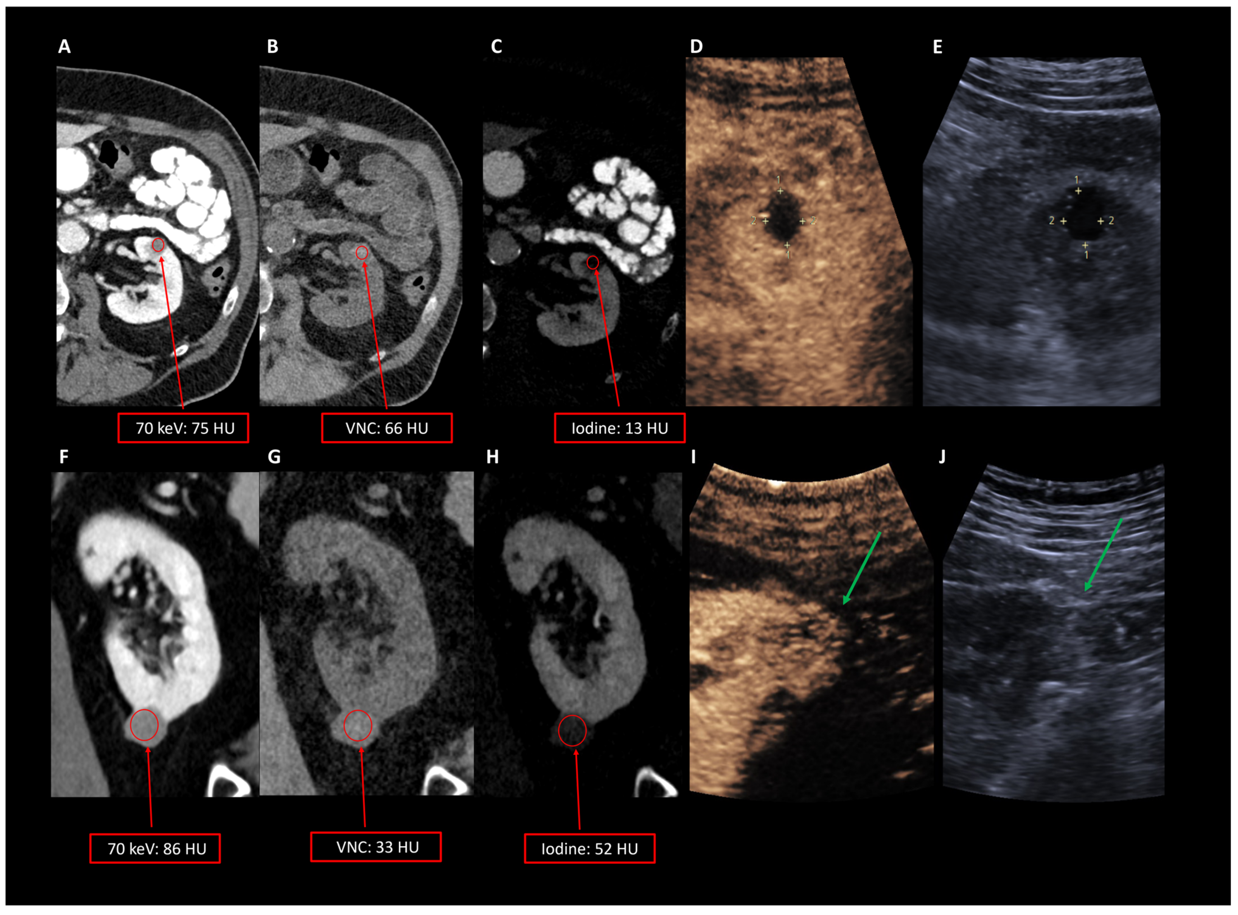 Diagnostics 15 00079 g003