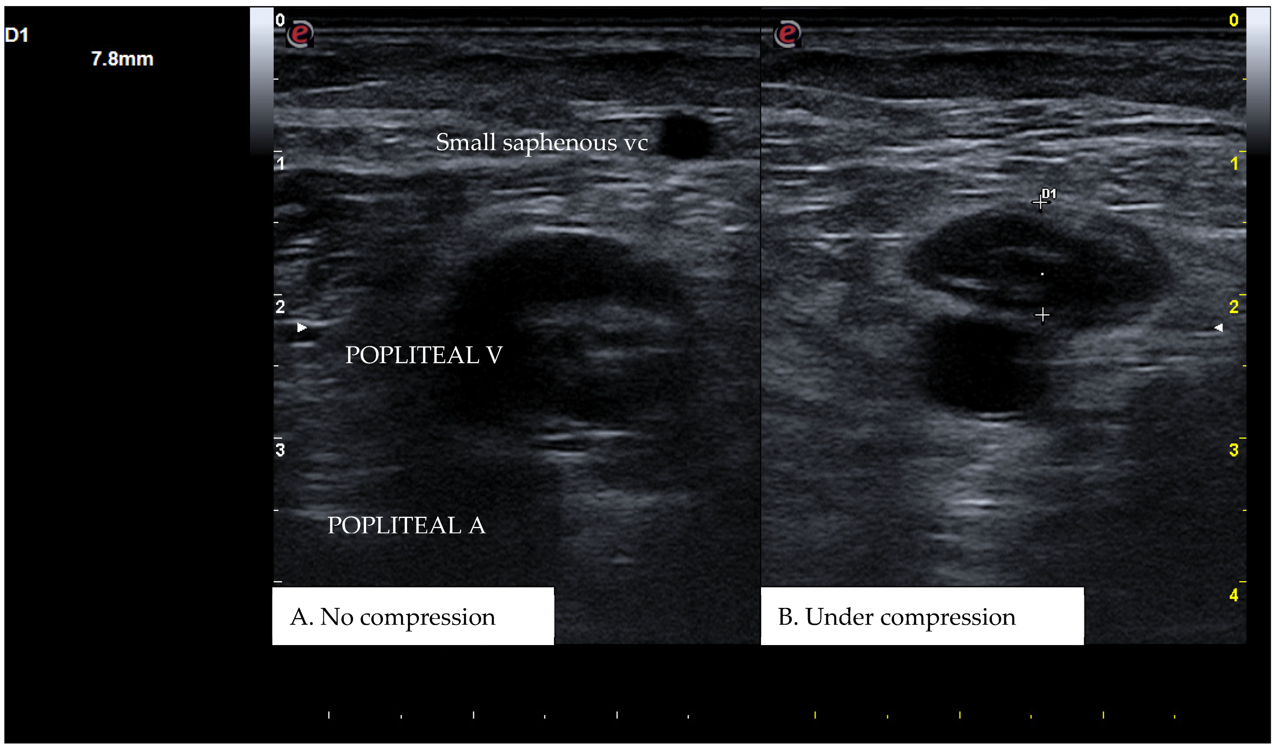 Diagnostics 15 00082 g002