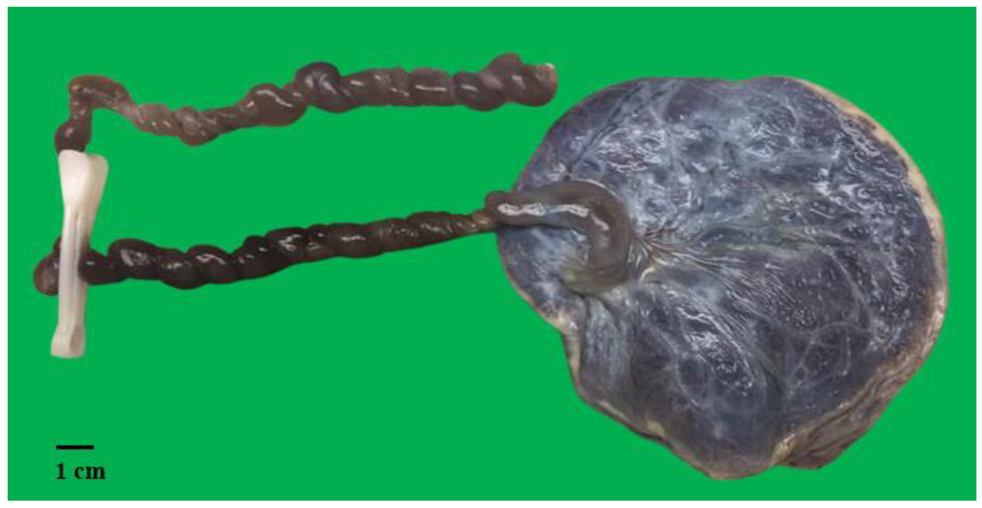 Diagnostics 15 00094 g001