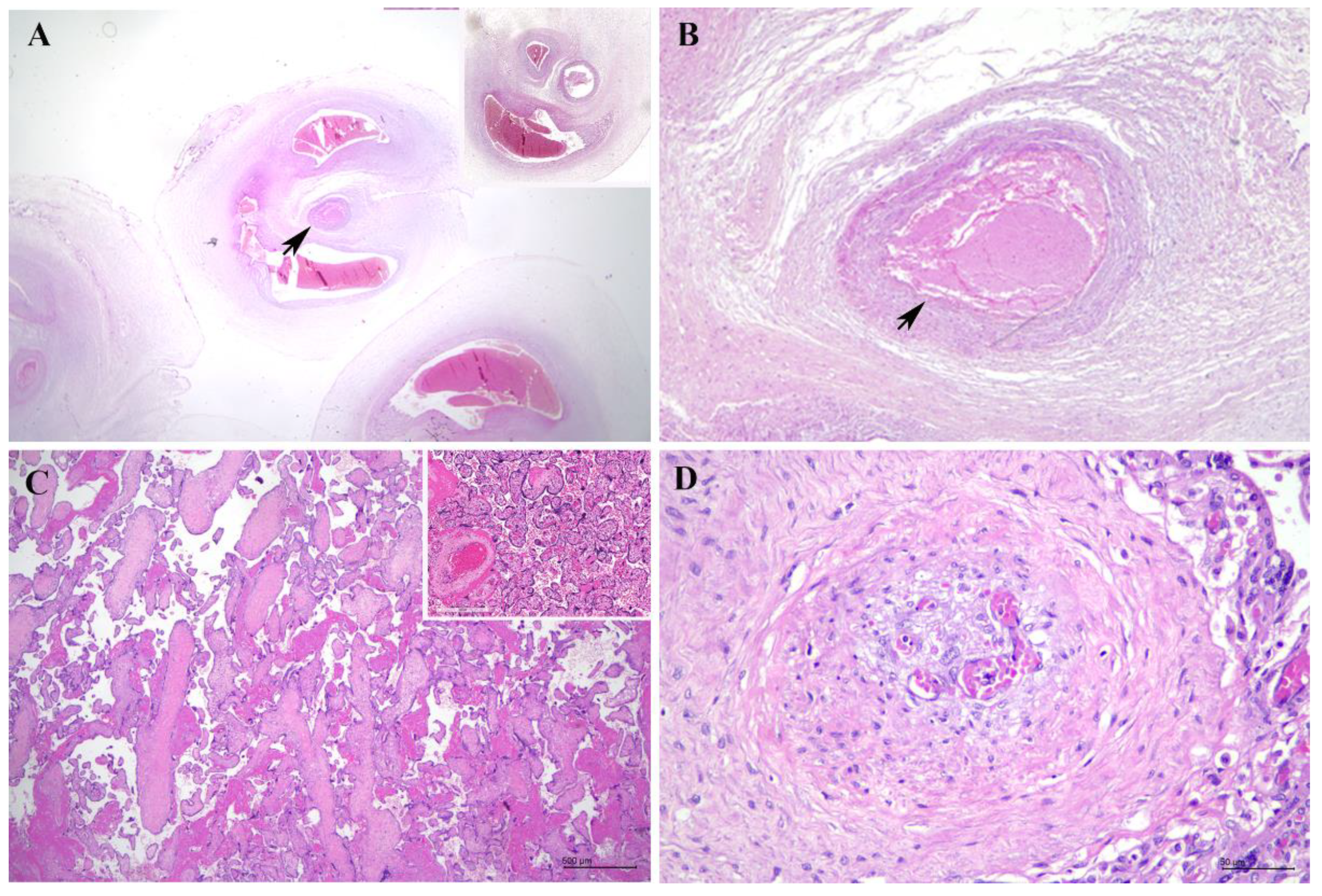 Diagnostics 15 00094 g002