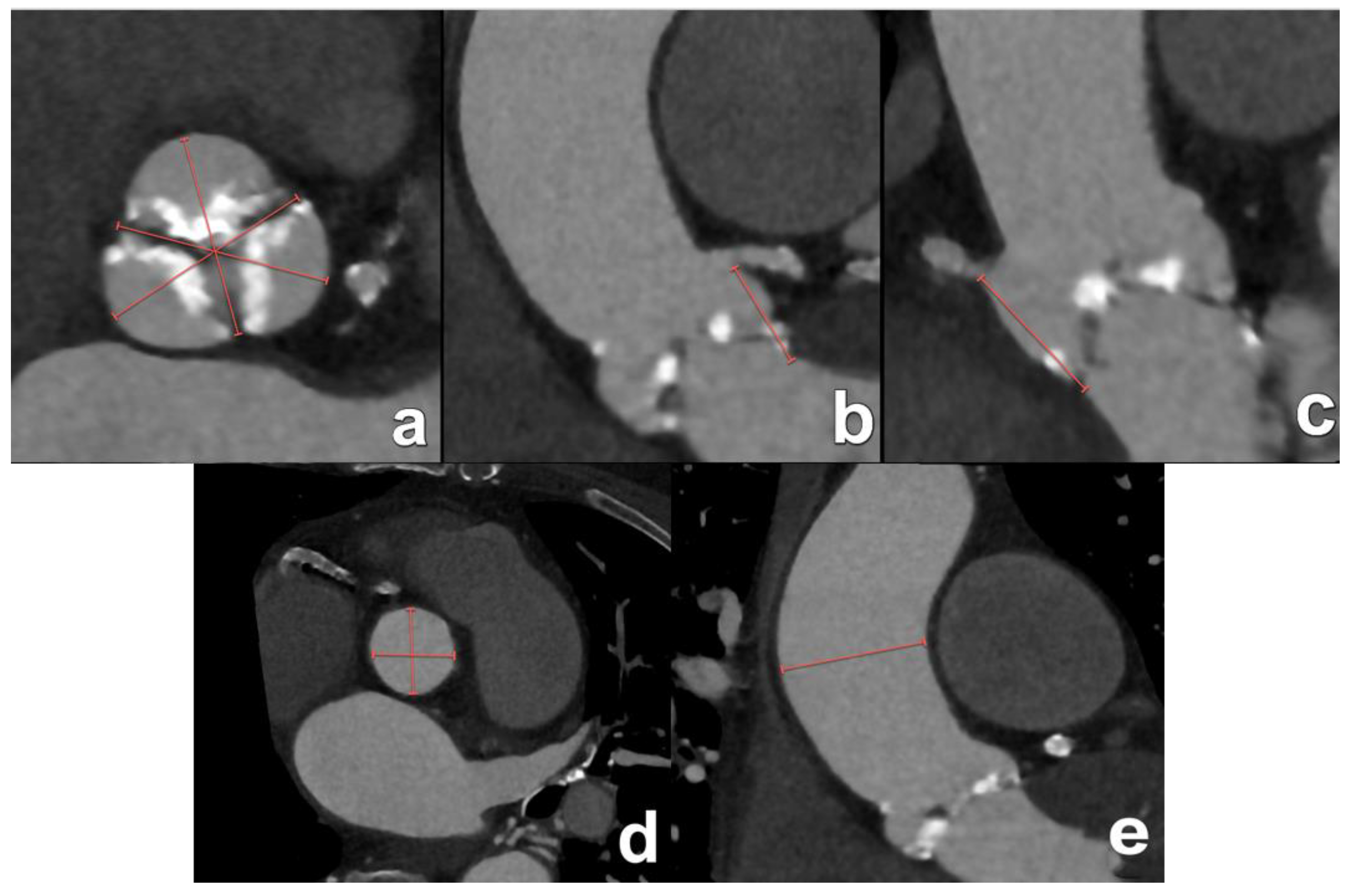 Diagnostics 15 00097 g006