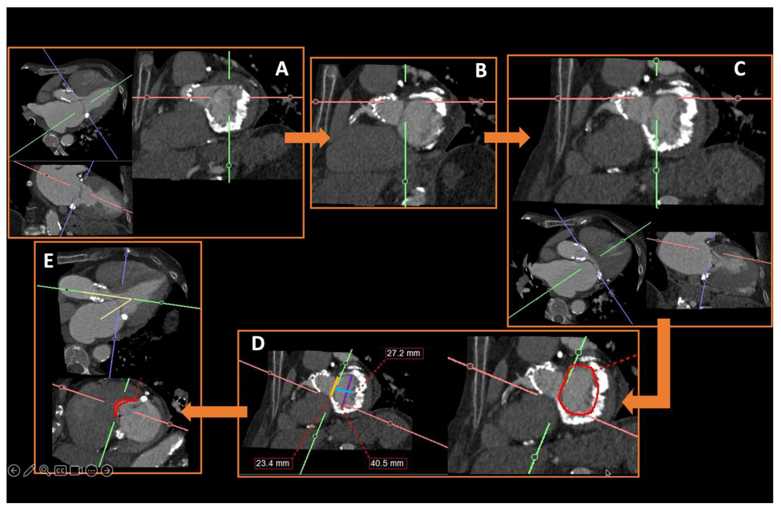 Diagnostics 15 00097 g010