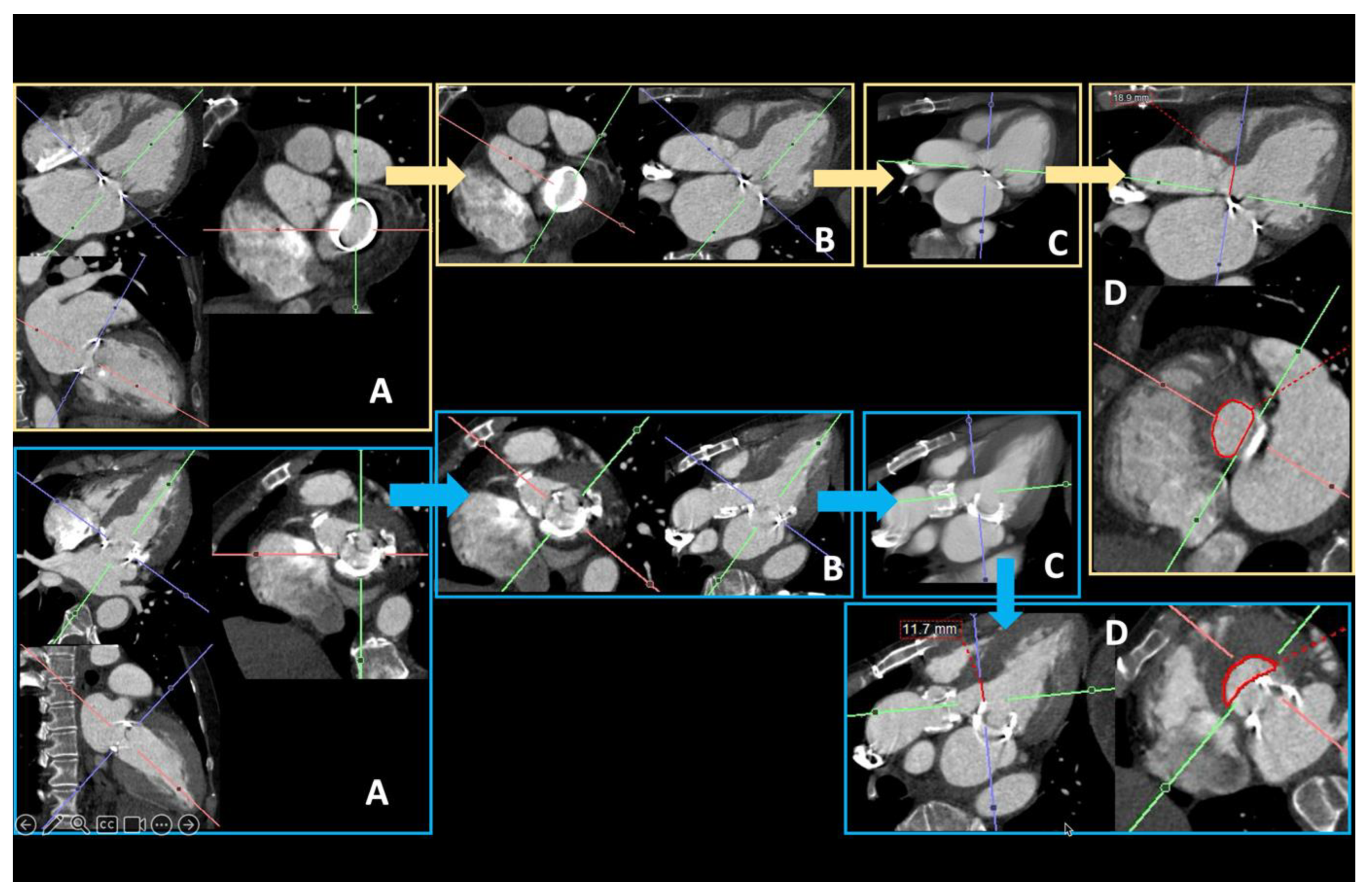 Diagnostics 15 00097 g011