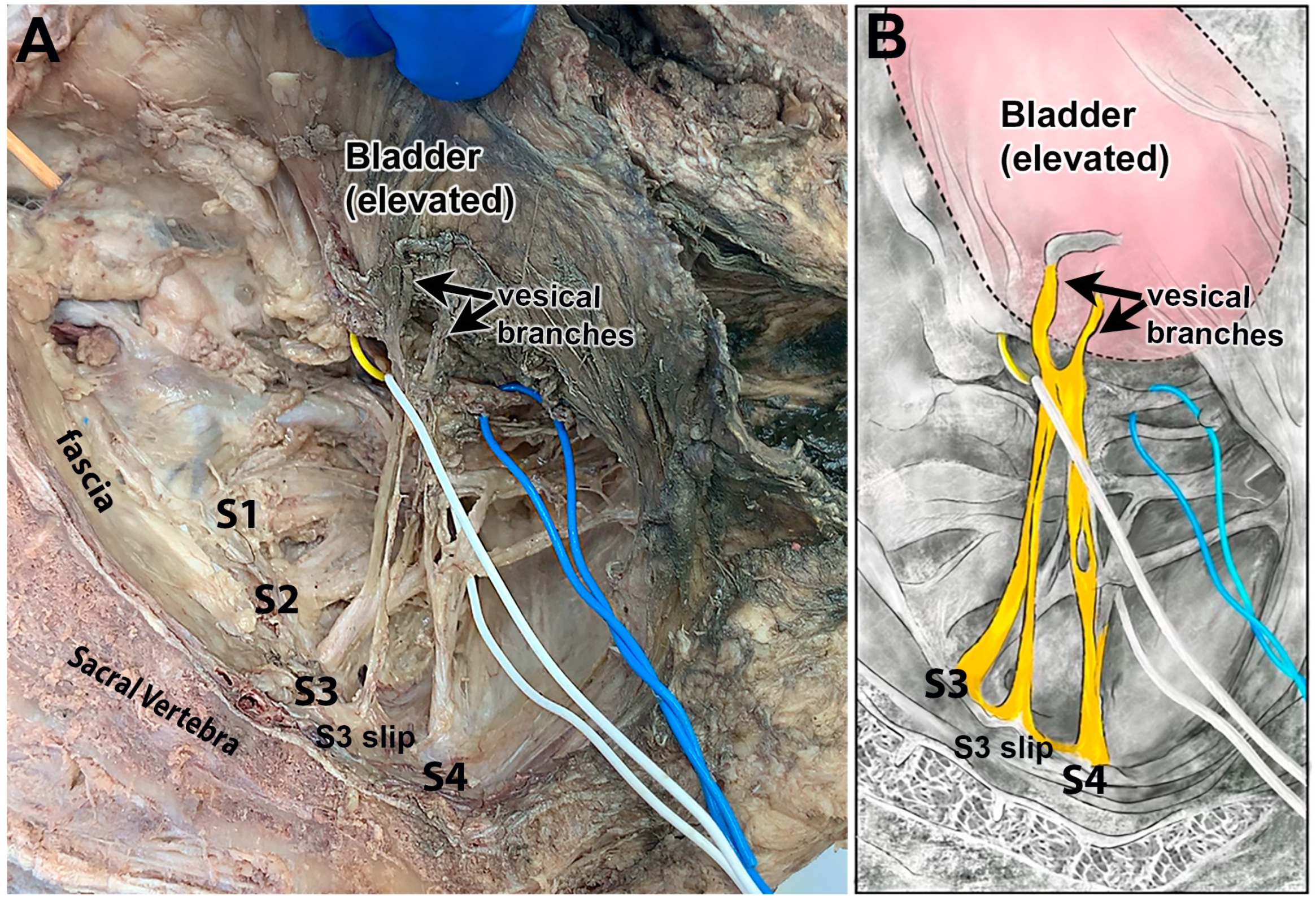 Diagnostics 15 00102 g004