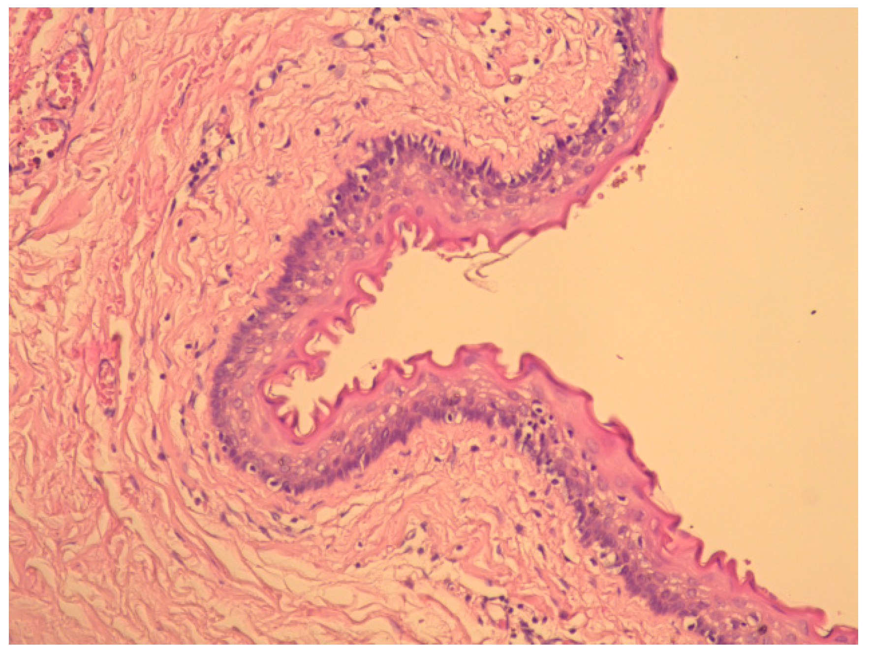 Diagnostics 15 00108 g004 Diagnostics 15 00108 g004