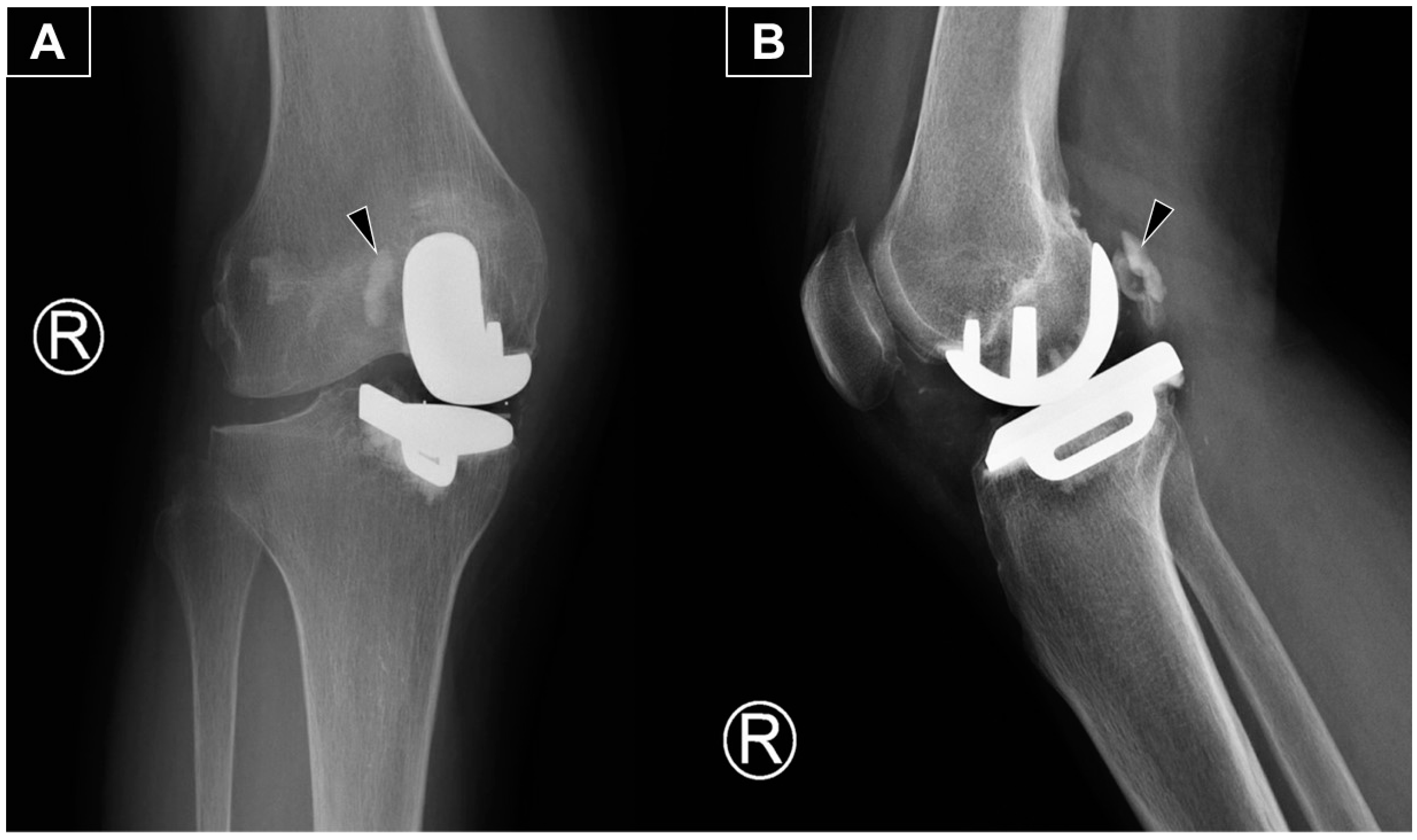 Diagnostics 15 00112 g001
