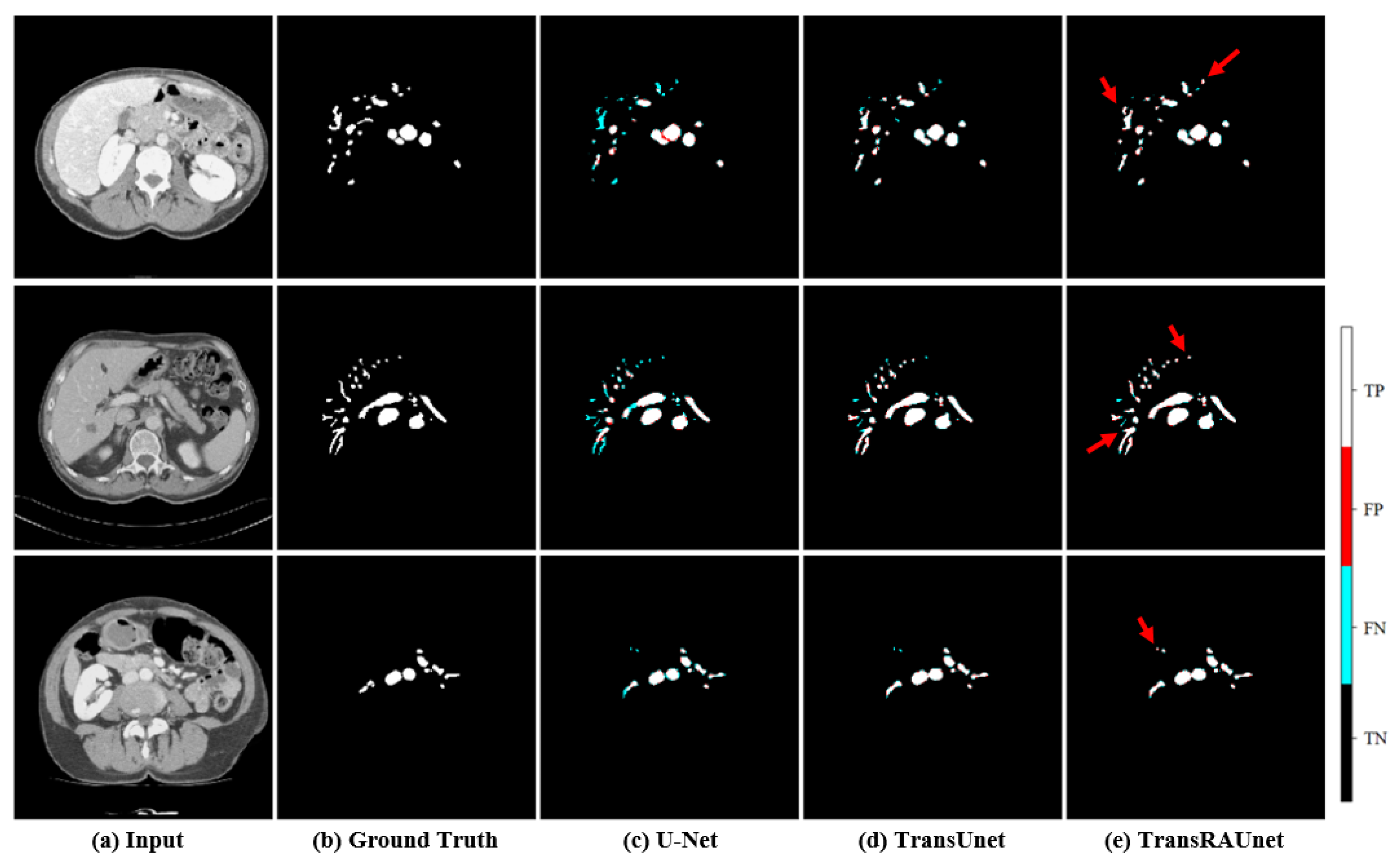 Diagnostics 15 00118 g006