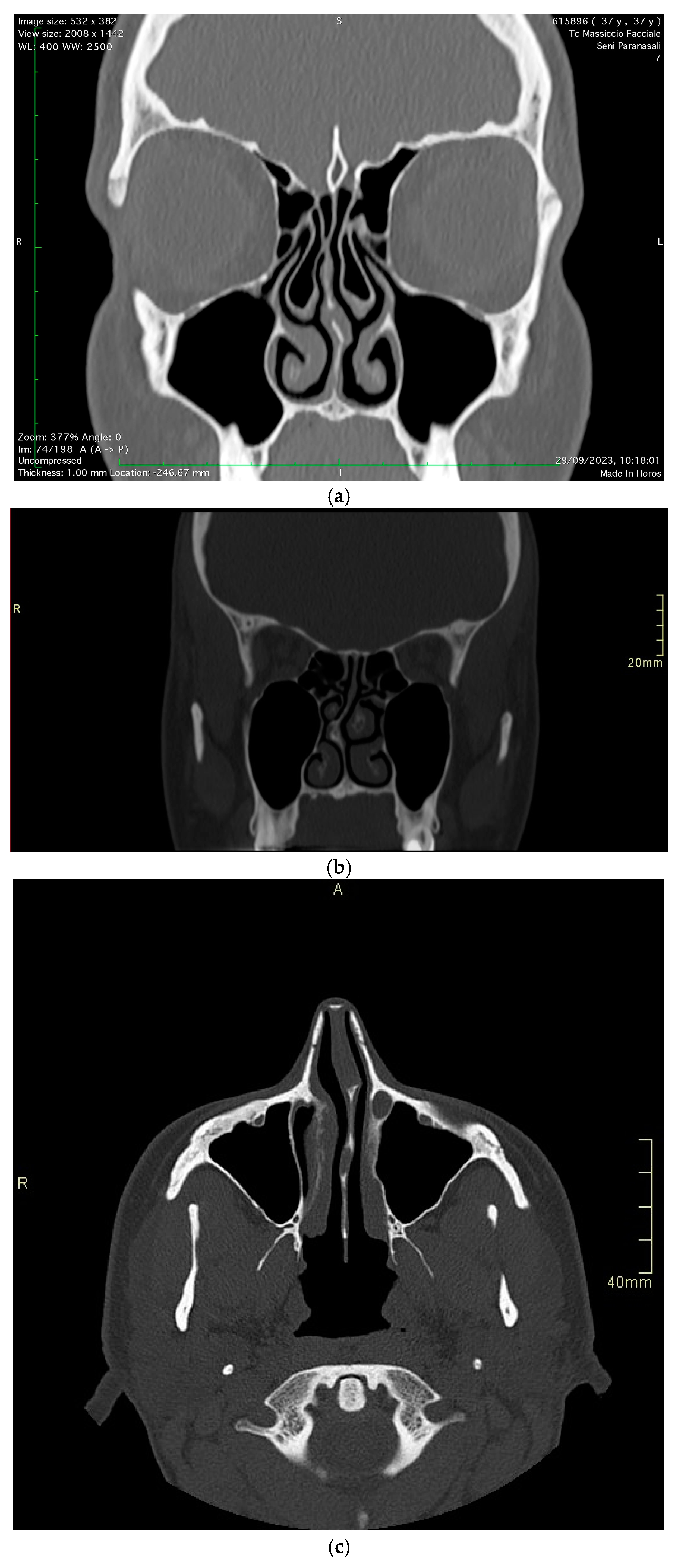 Diagnostics 15 00121 g002