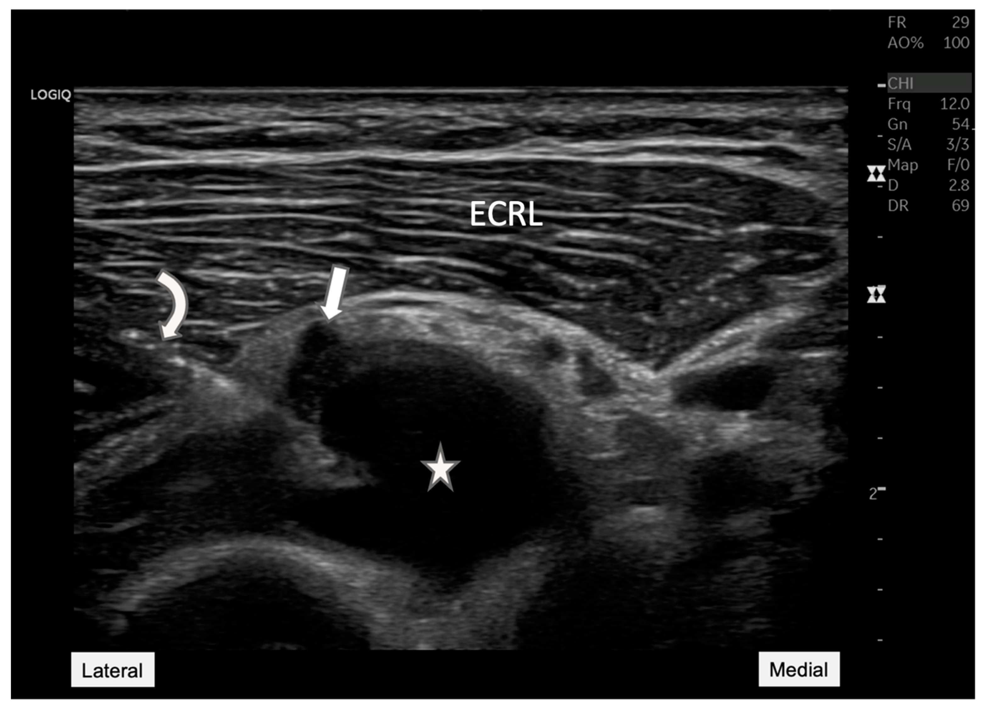 Diagnostics 15 00124 g004