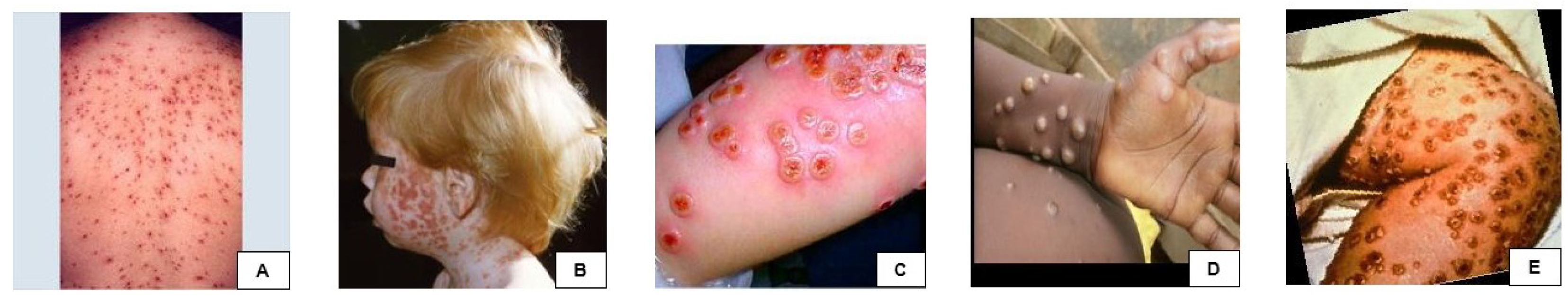 Diagnostics 15 00130 g002