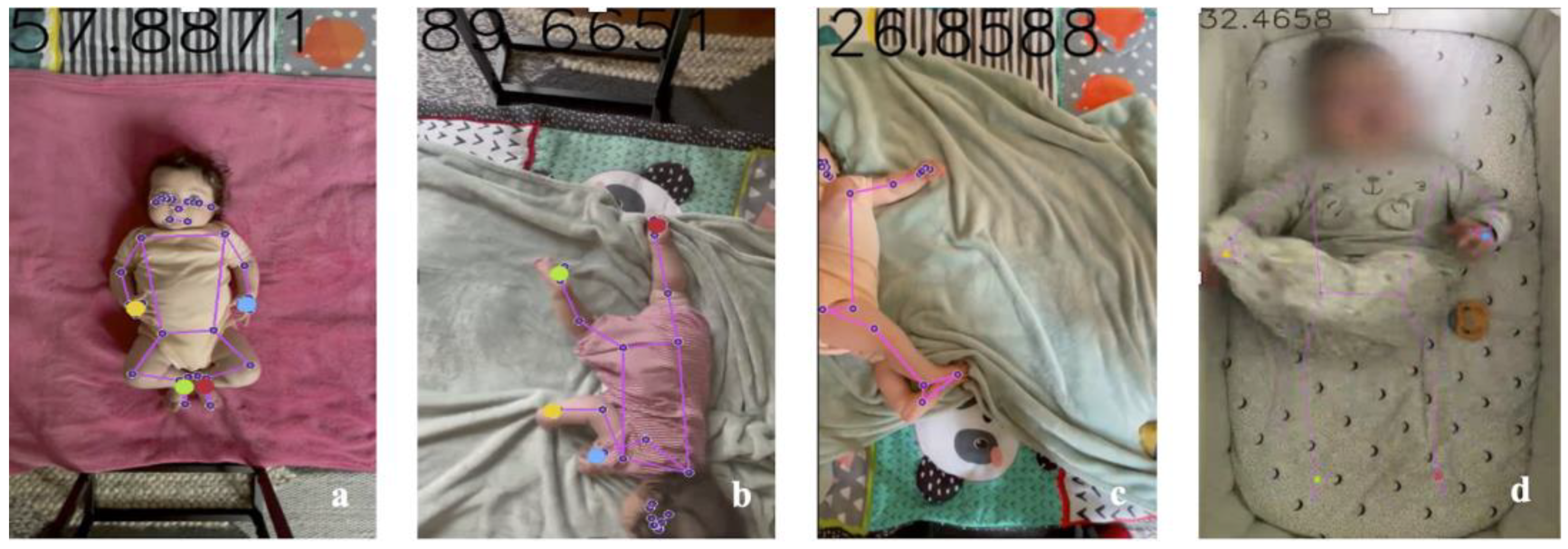 Diagnostics 15 00136 g005