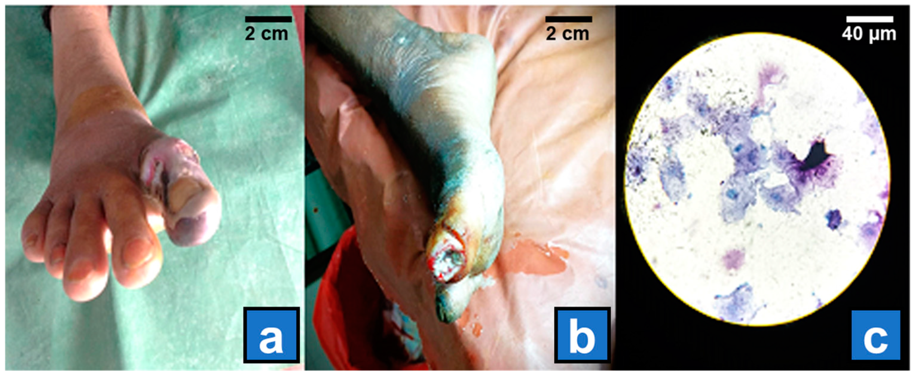 Diagnostics 15 00141 g001 Diagnostics 15 00141 g001