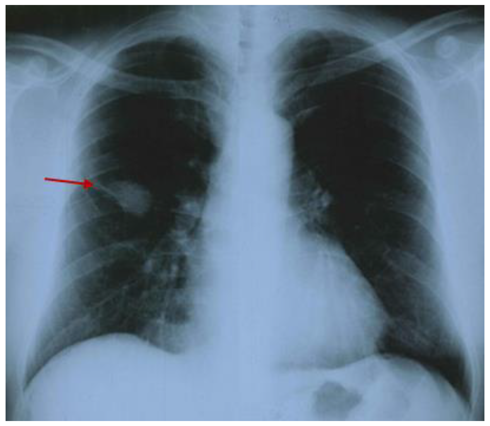 Diagnostics 15 00144 g002 Diagnostics 15 00144 g002