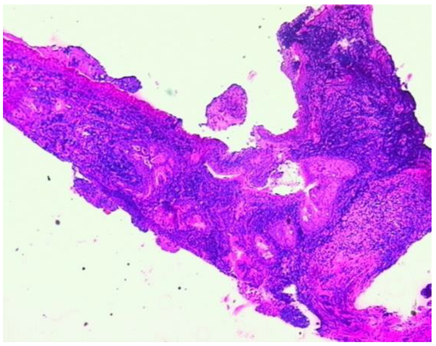 Diagnostics 15 00144 g003 Diagnostics 15 00144 g003