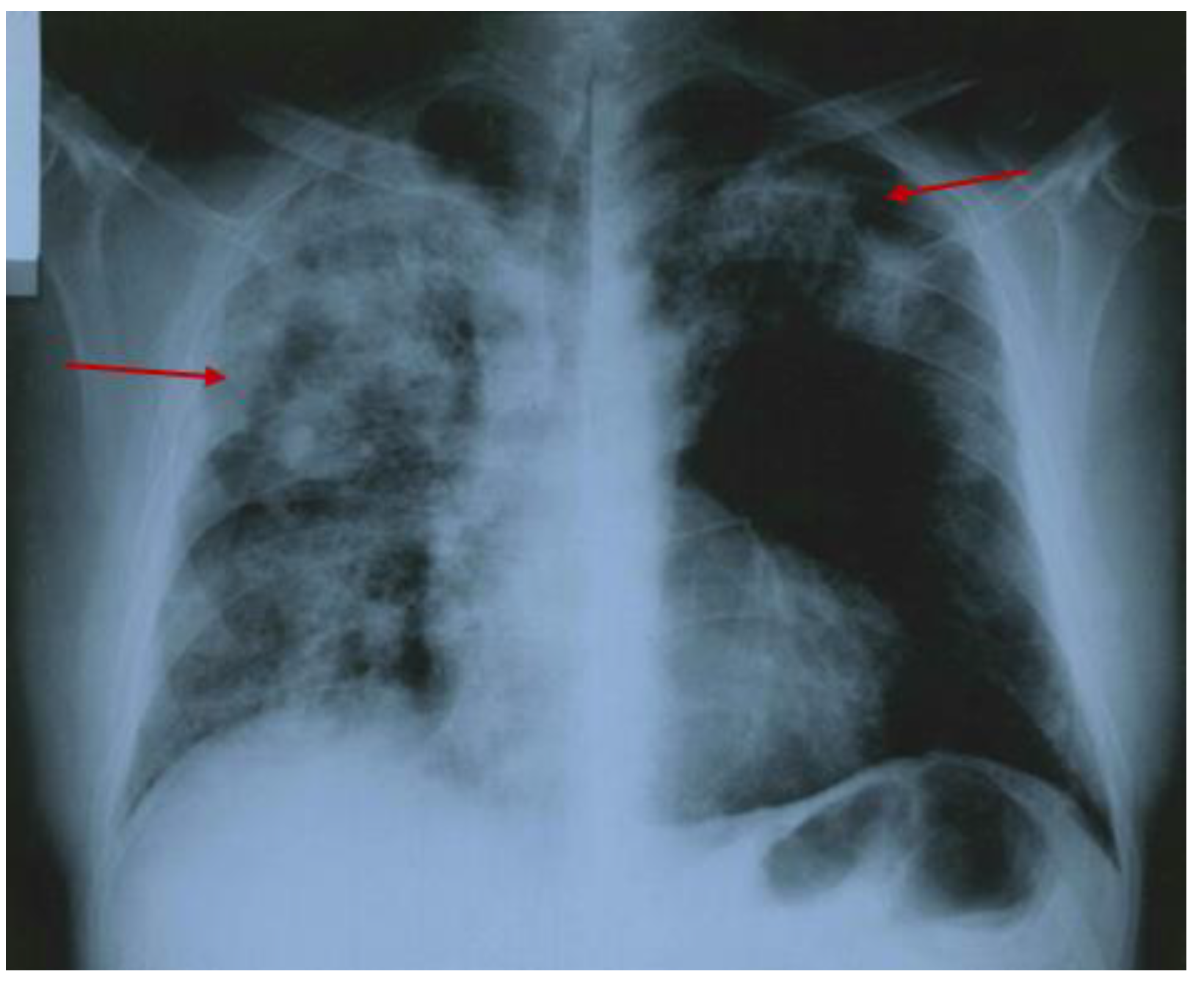 Diagnostics 15 00144 g005 Diagnostics 15 00144 g005