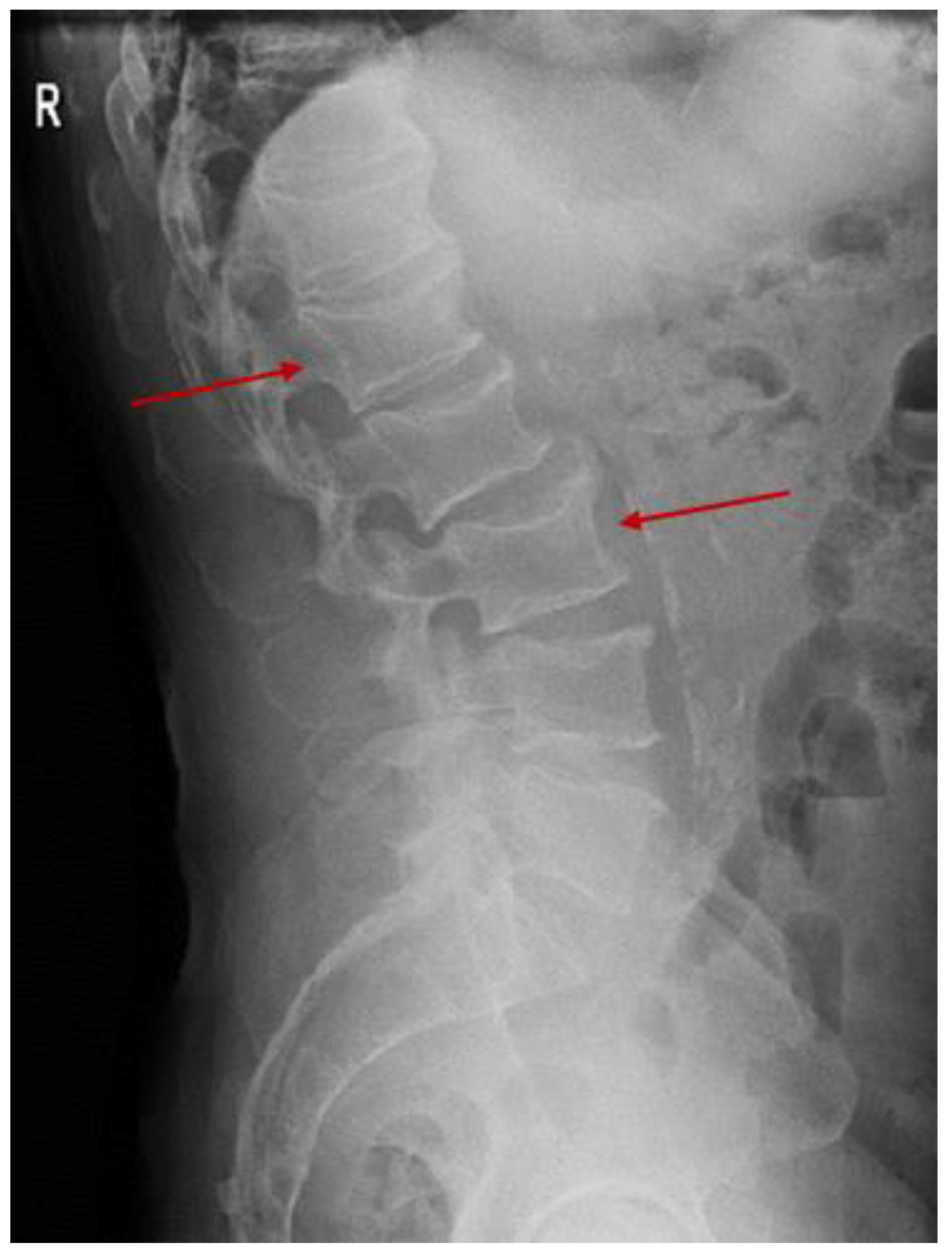 Diagnostics 15 00144 g006 Diagnostics 15 00144 g006