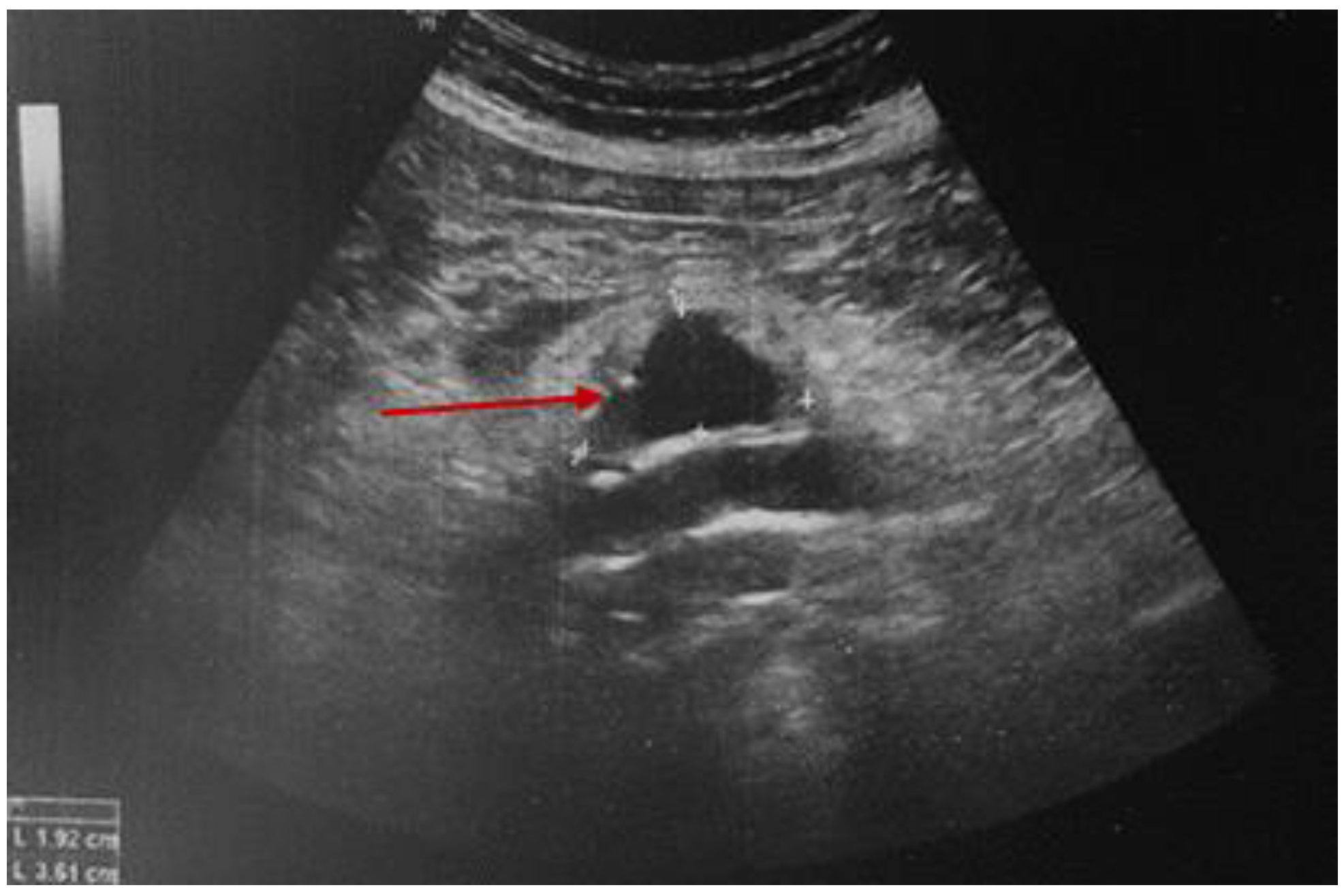 Diagnostics 15 00144 g008 Diagnostics 15 00144 g008