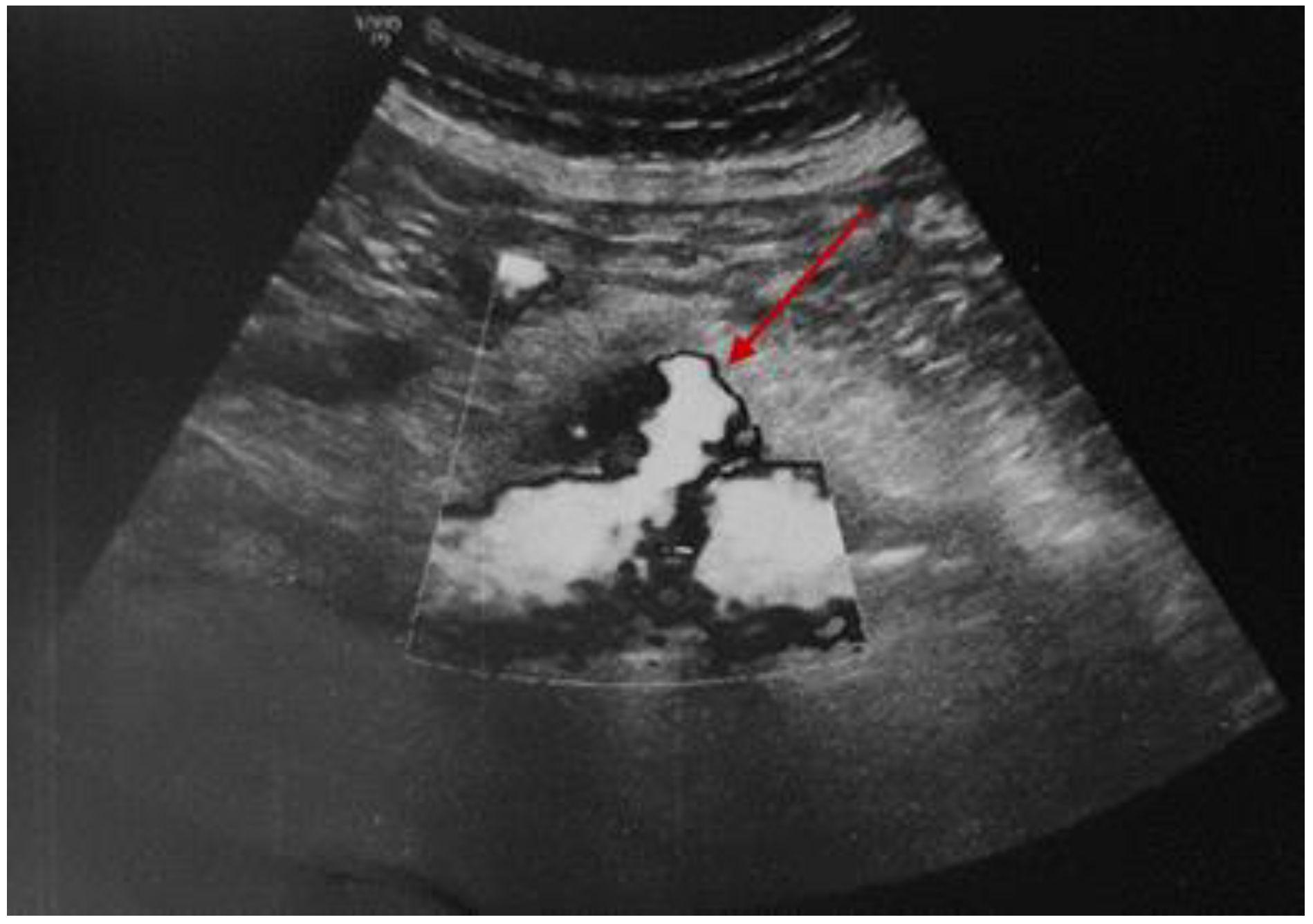 Diagnostics 15 00144 g009 Diagnostics 15 00144 g009