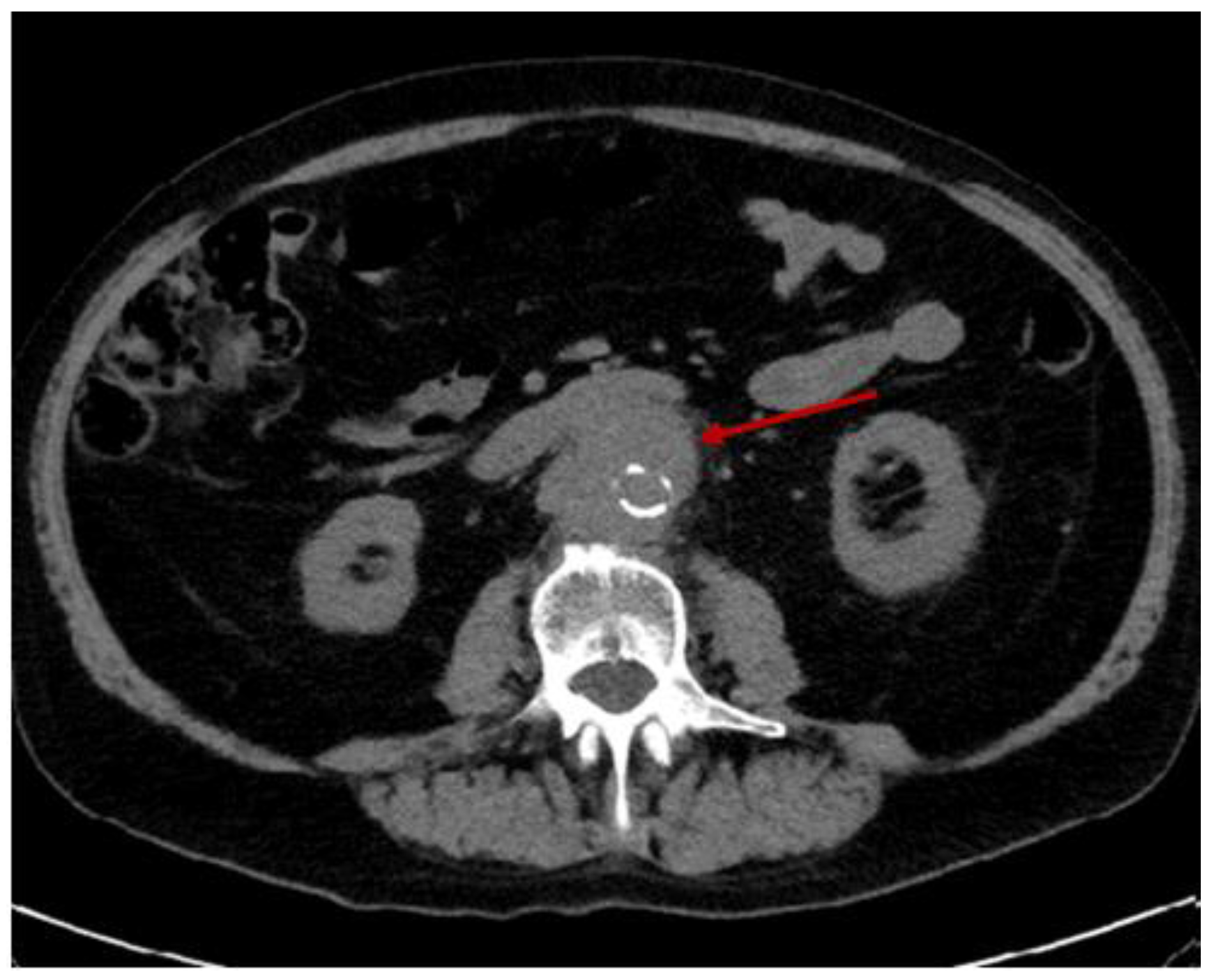Diagnostics 15 00144 g010 Diagnostics 15 00144 g010