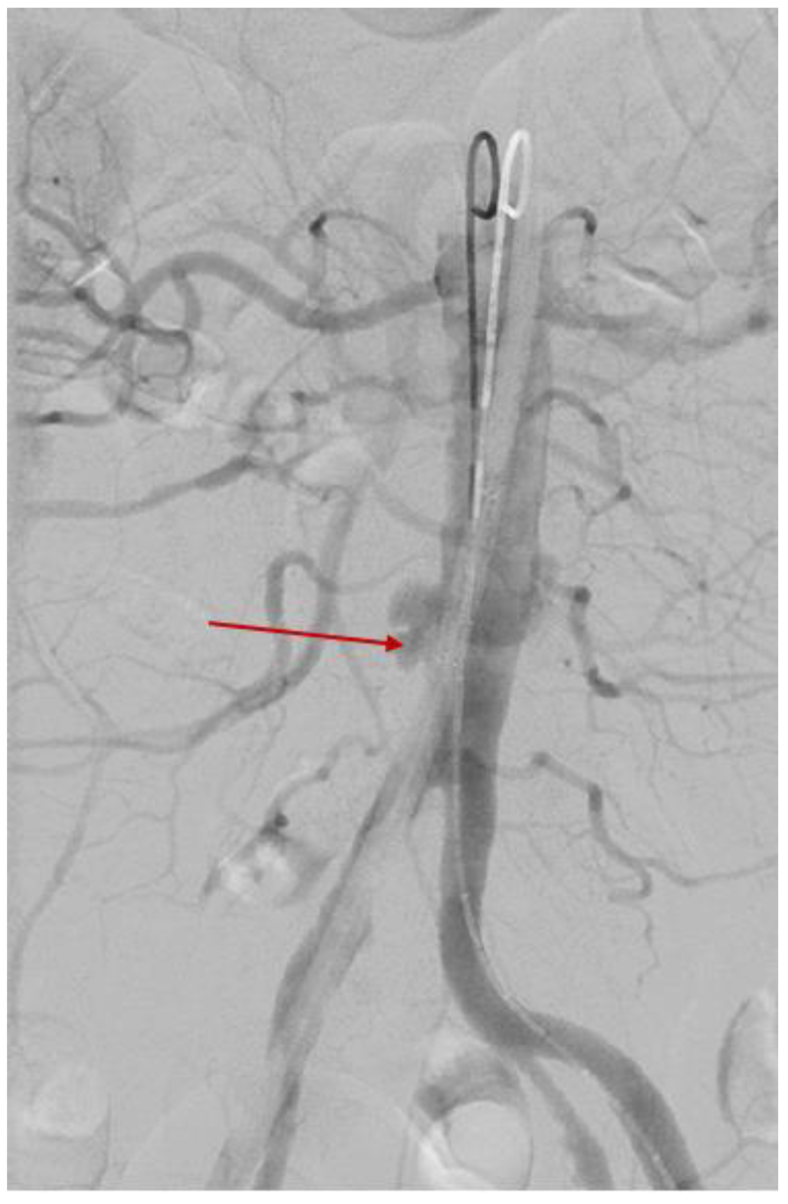 Diagnostics 15 00144 g011 Diagnostics 15 00144 g011