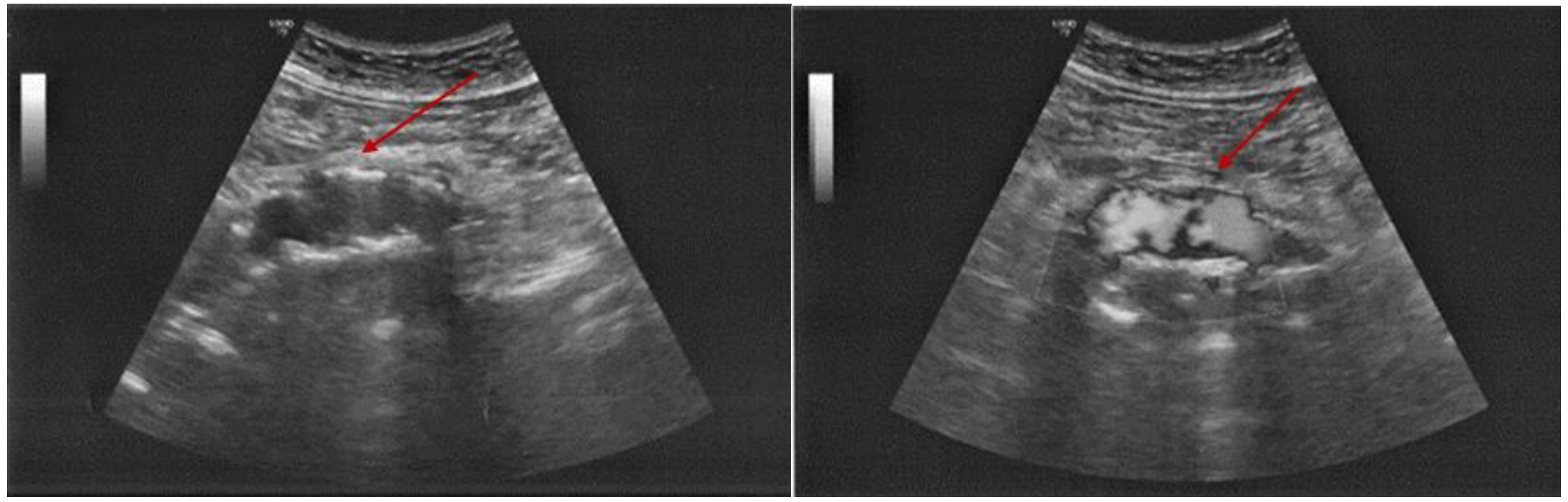 Diagnostics 15 00144 g013 Diagnostics 15 00144 g013