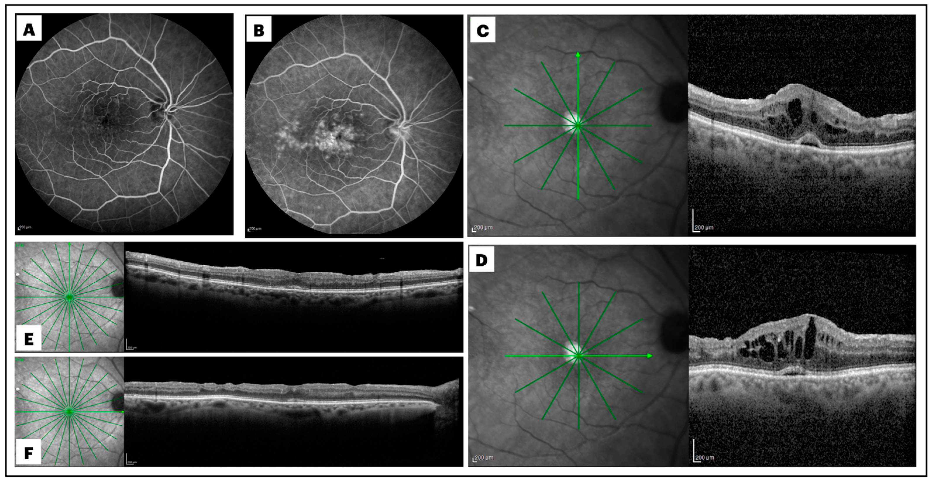 Diagnostics 15 00147 g001