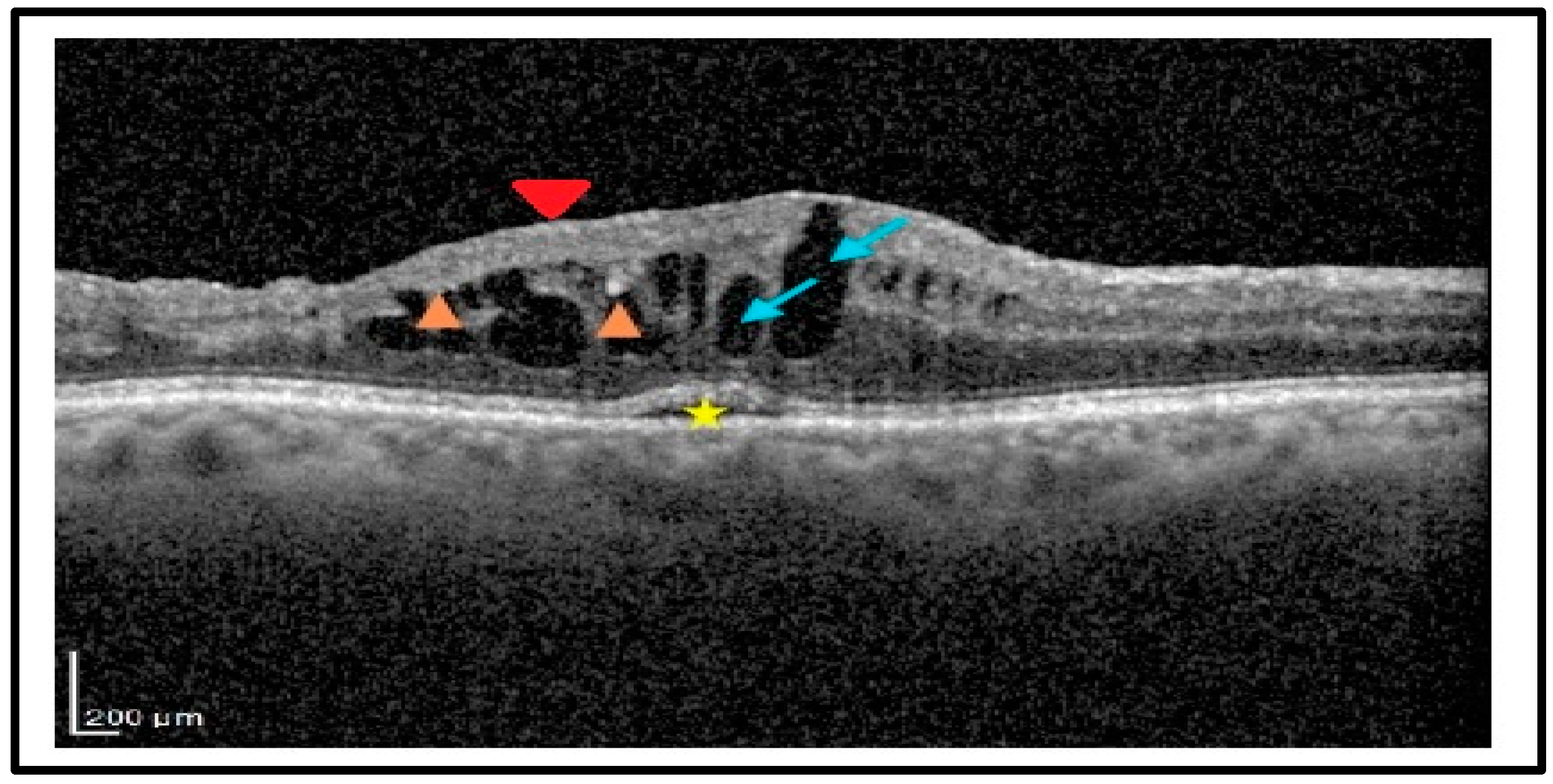 Diagnostics 15 00147 g002