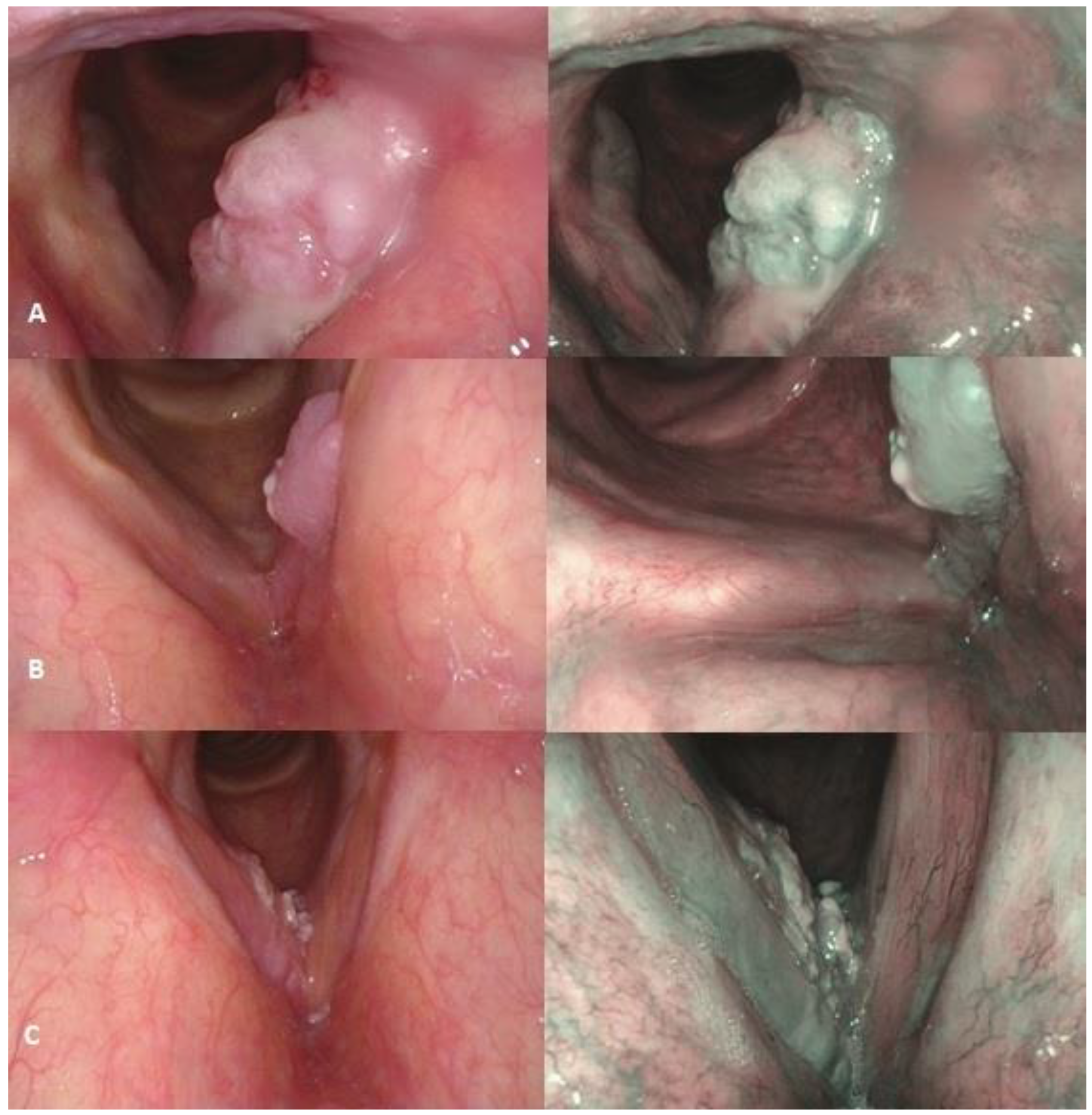 Diagnostics 15 00150 g001