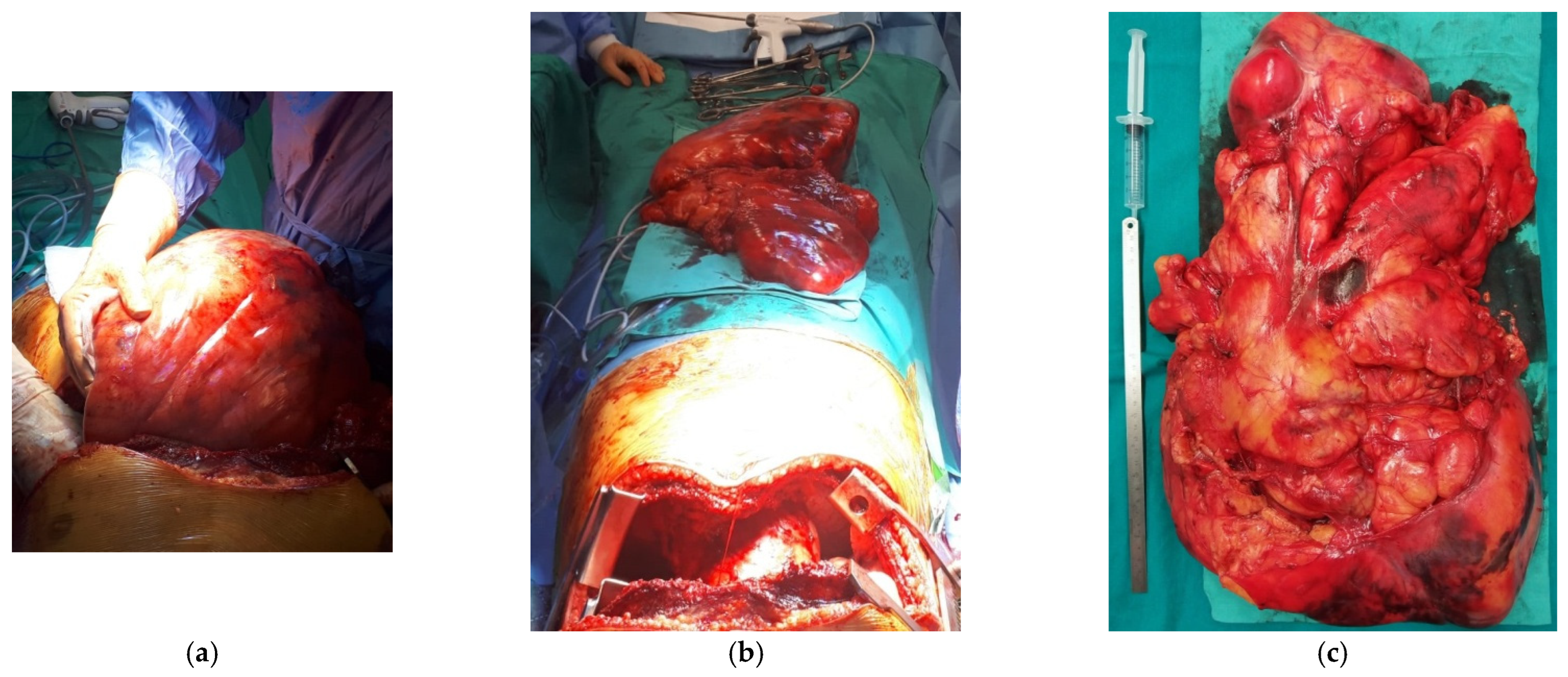 Diagnostics 15 00159 g005