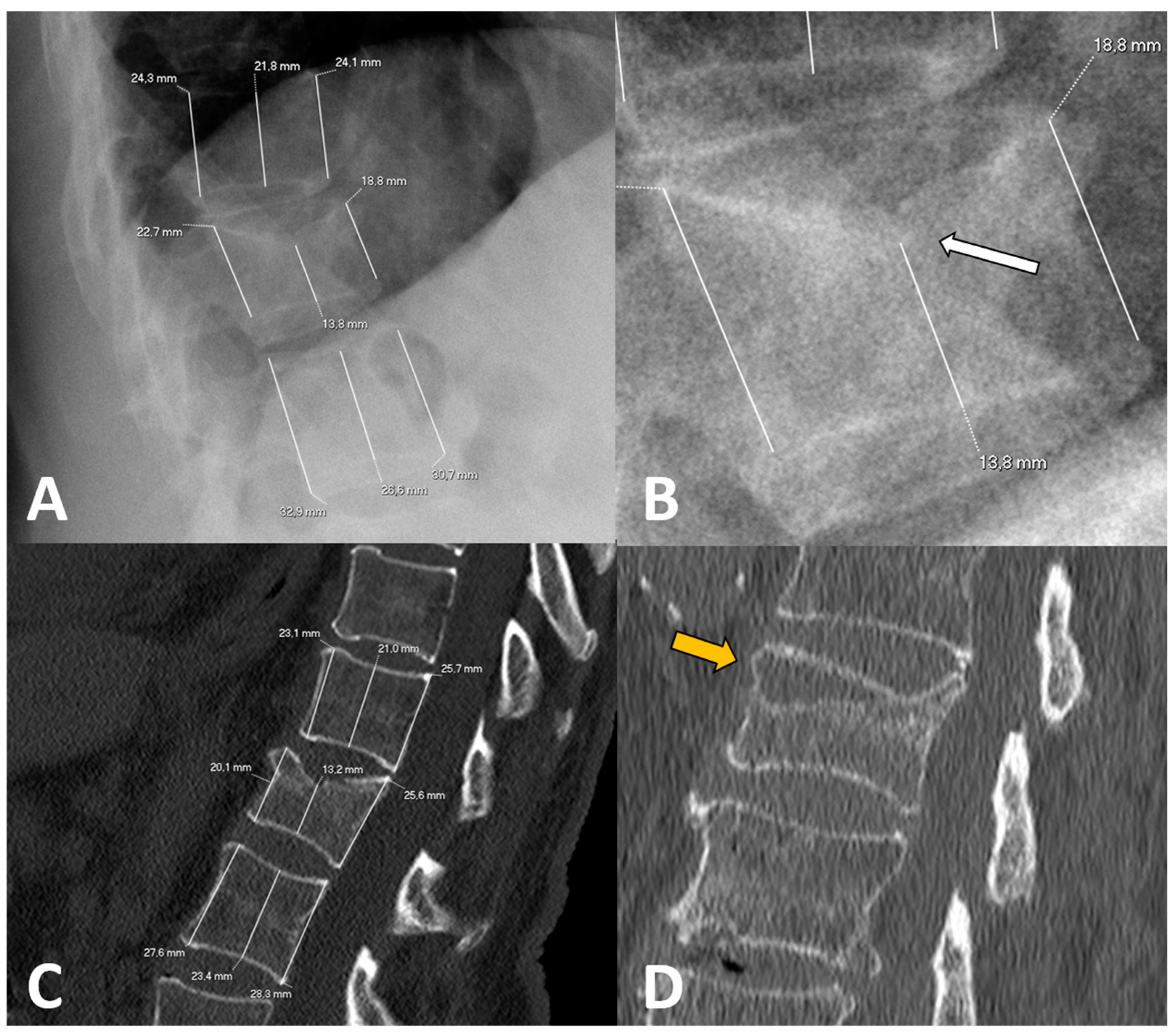Diagnostics 15 00160 g001