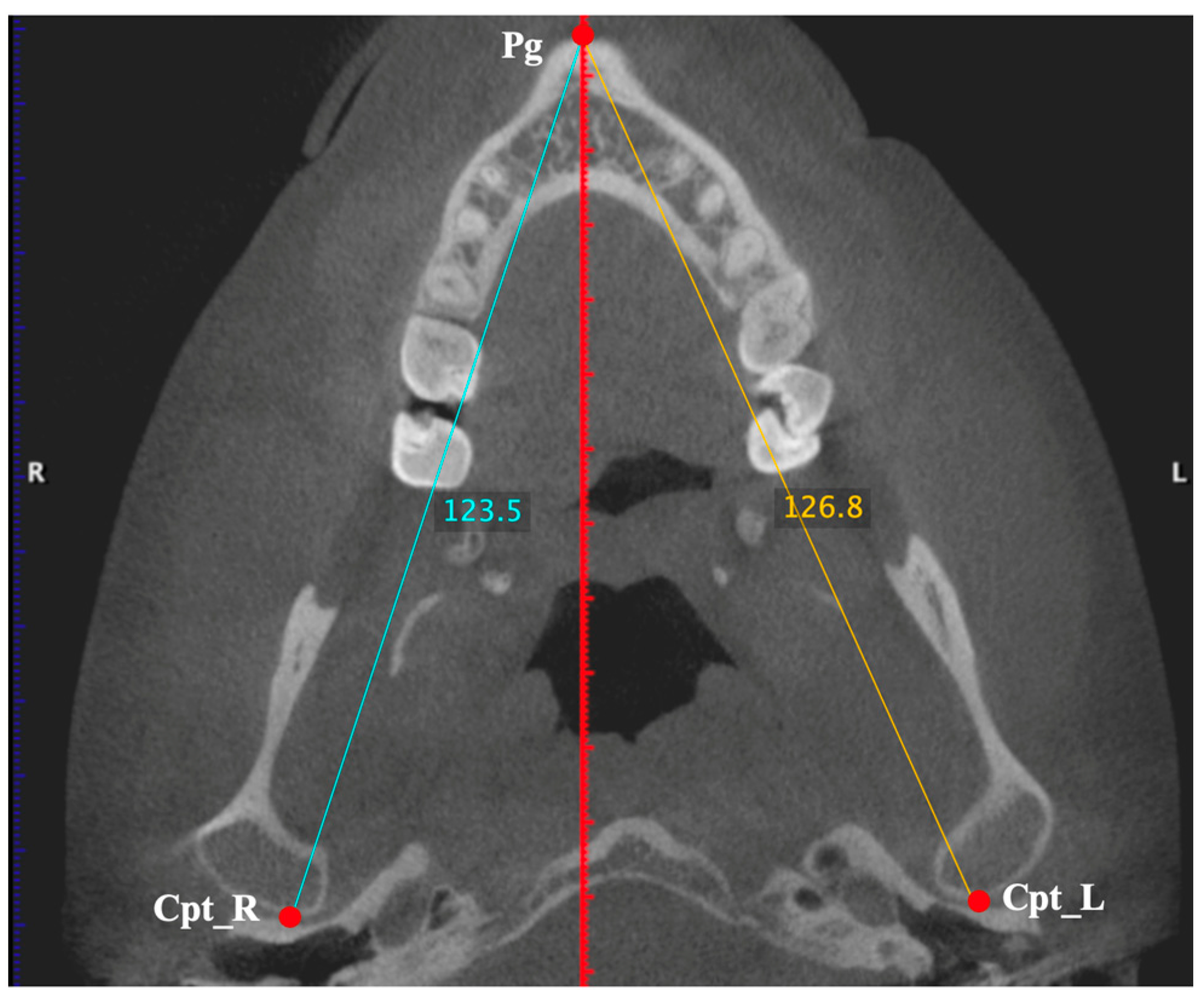 Diagnostics 15 00161 g003